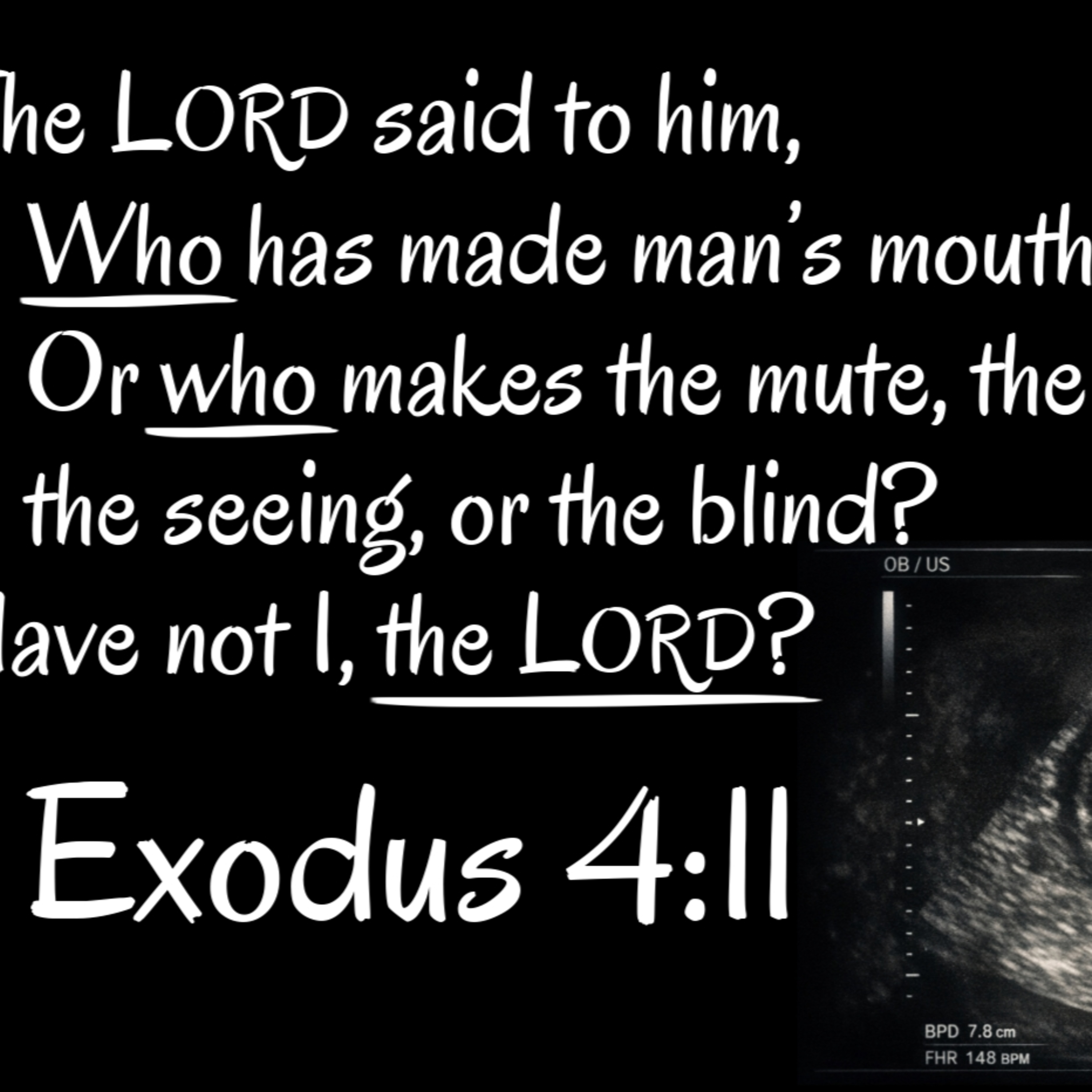 Exodus 3:10-22 | God's Presence > Moses' Excuses, Part 1 episode artwork