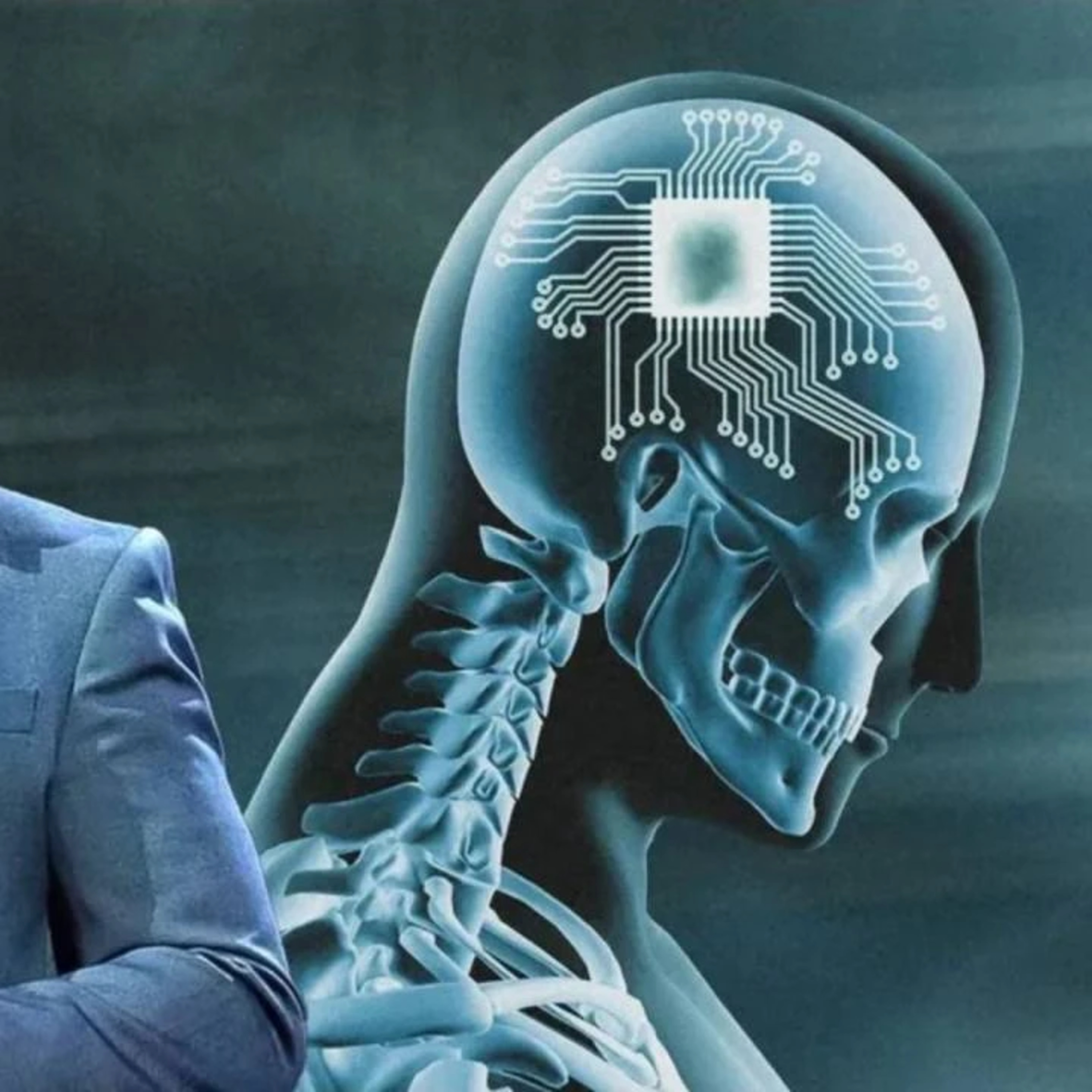 Neuralink: نيورالينك: دمج البشر مع الذكاء الاصطناعي