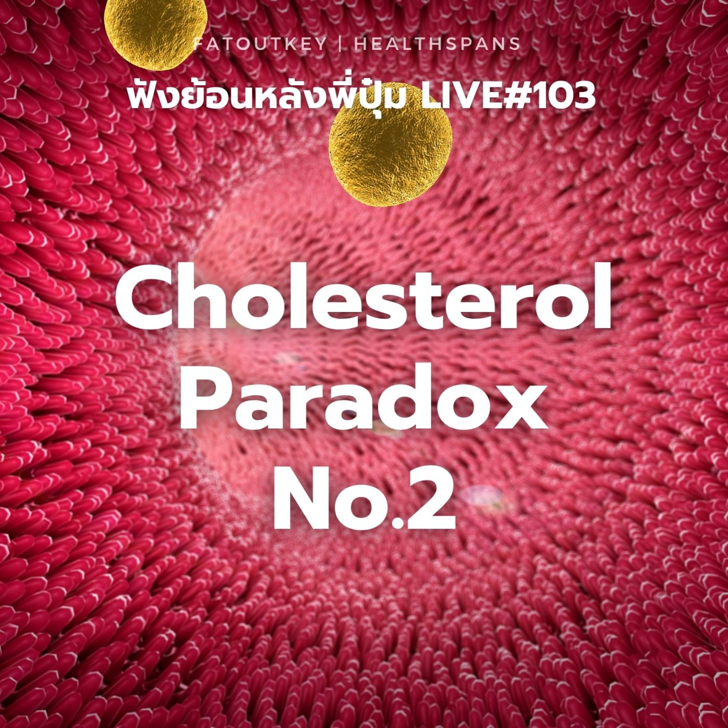Cholesterol Paradox No.2 (Live 103)