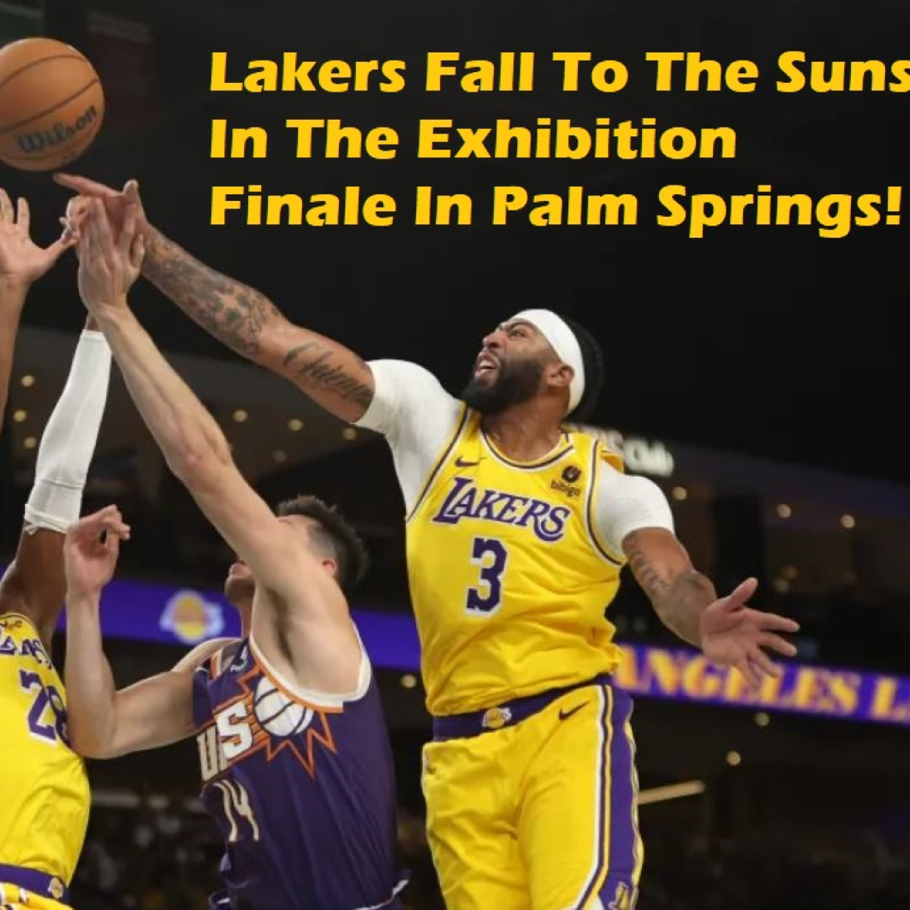 Lakers-Suns Postgame! Lakers Get Sun Burned In Palm Springs!