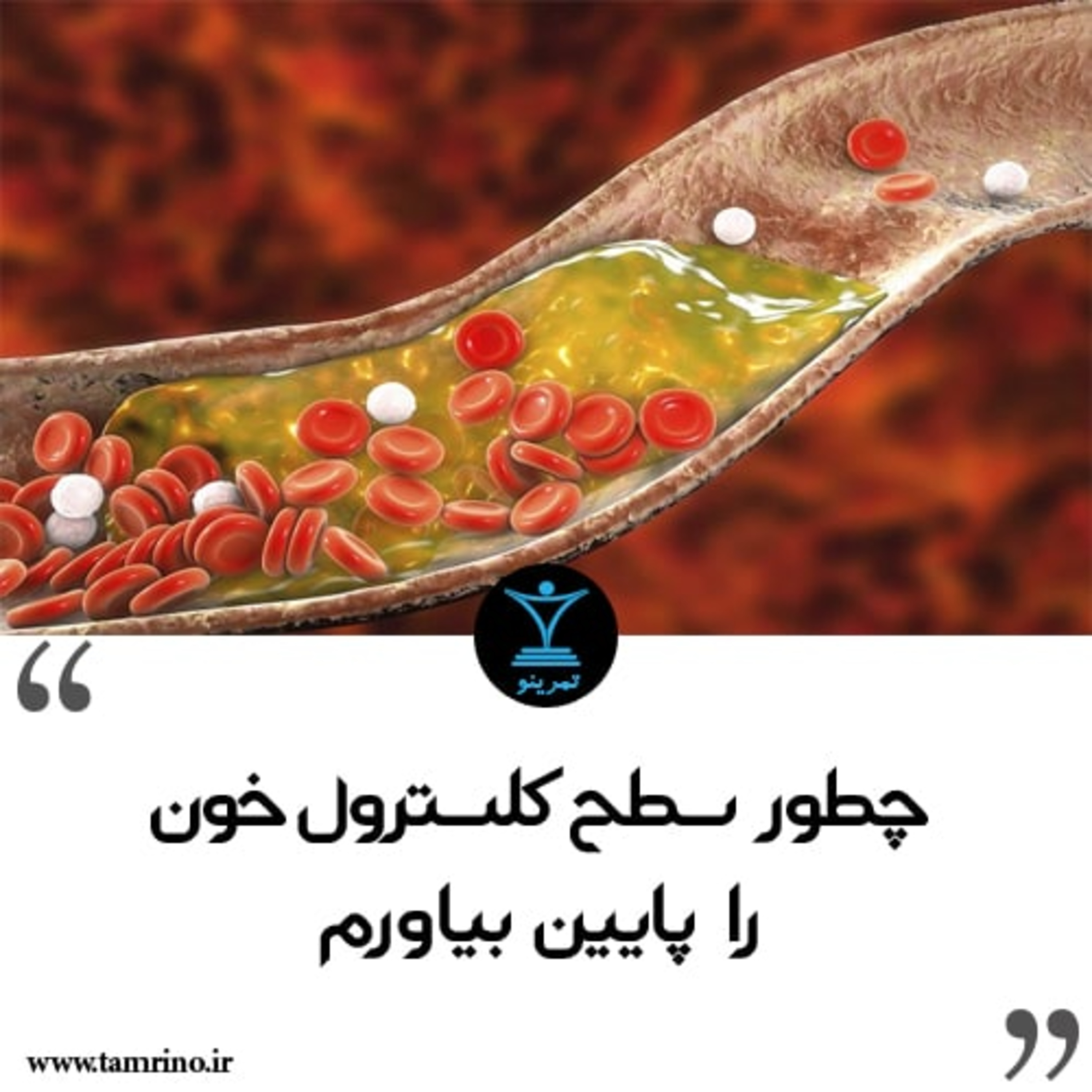 چطور سطح کلسترول خون را پایین بیاورم؟ episode artwork