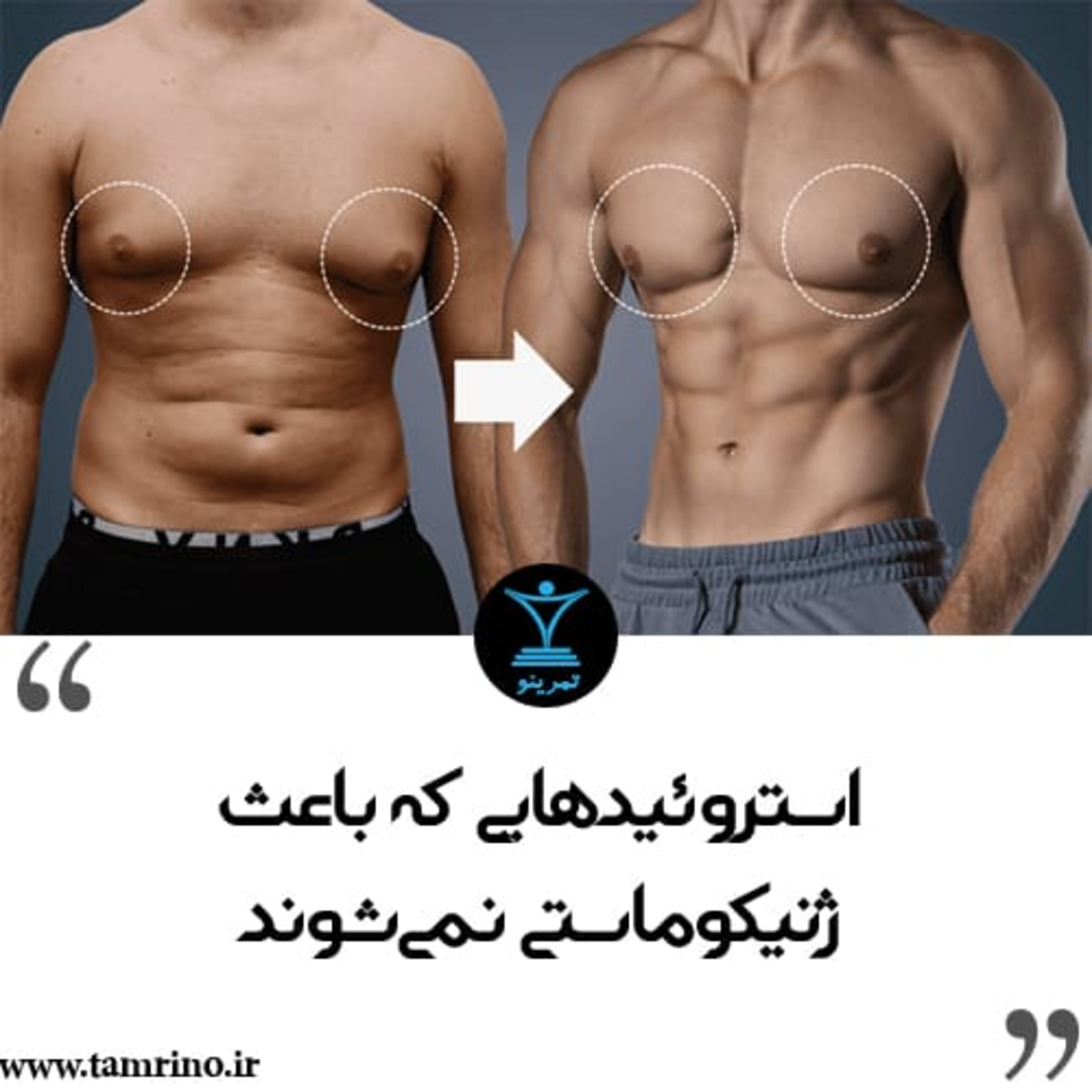 استروئیدهایی که باعث ژنیکوماستی نمی‌شوند (نسخه هوش مصنوعی) episode artwork