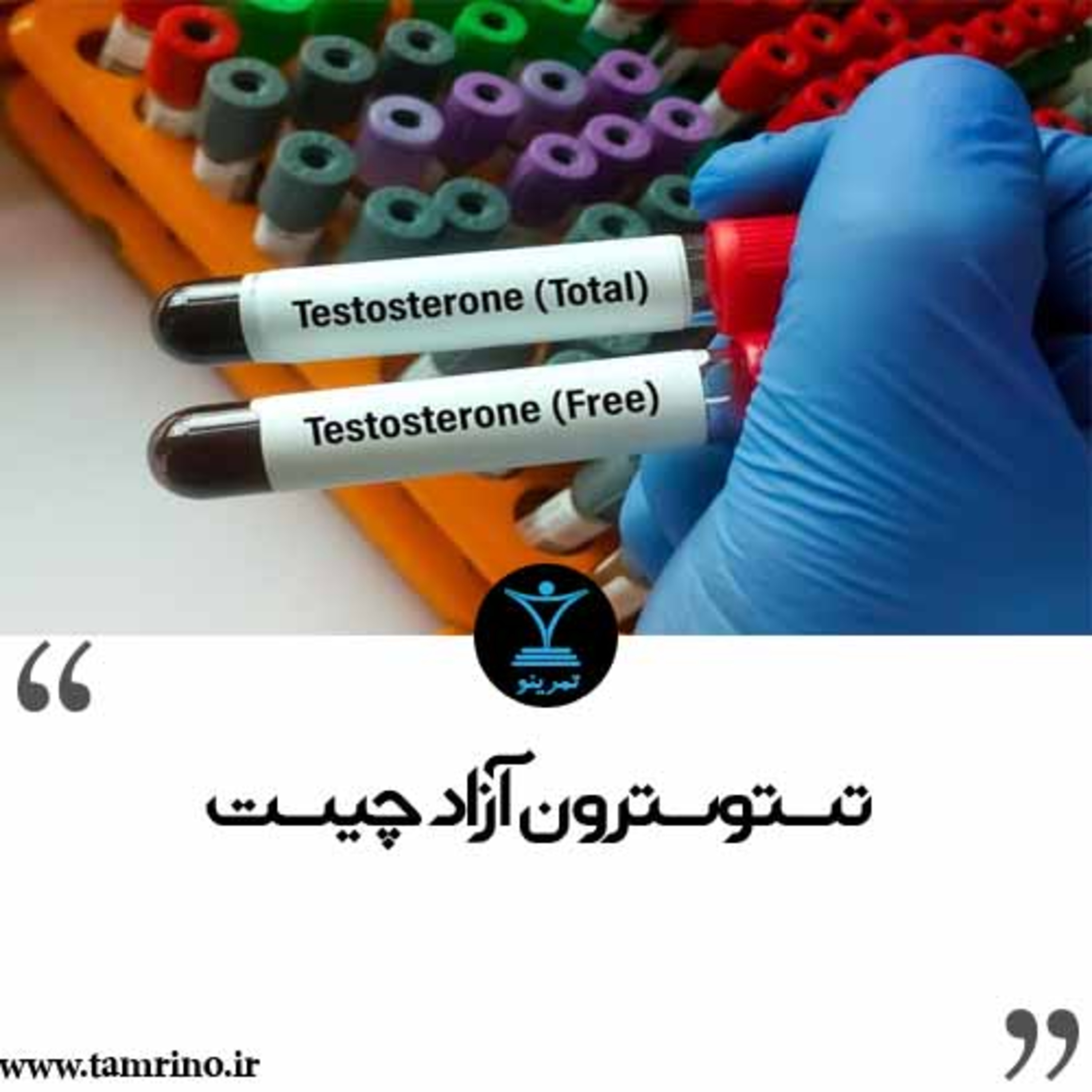 تستوسترون آزاد چیست و چگونه اندازه‌گیری می‌شود؟ (نسخه هوش مصنوعی) episode artwork