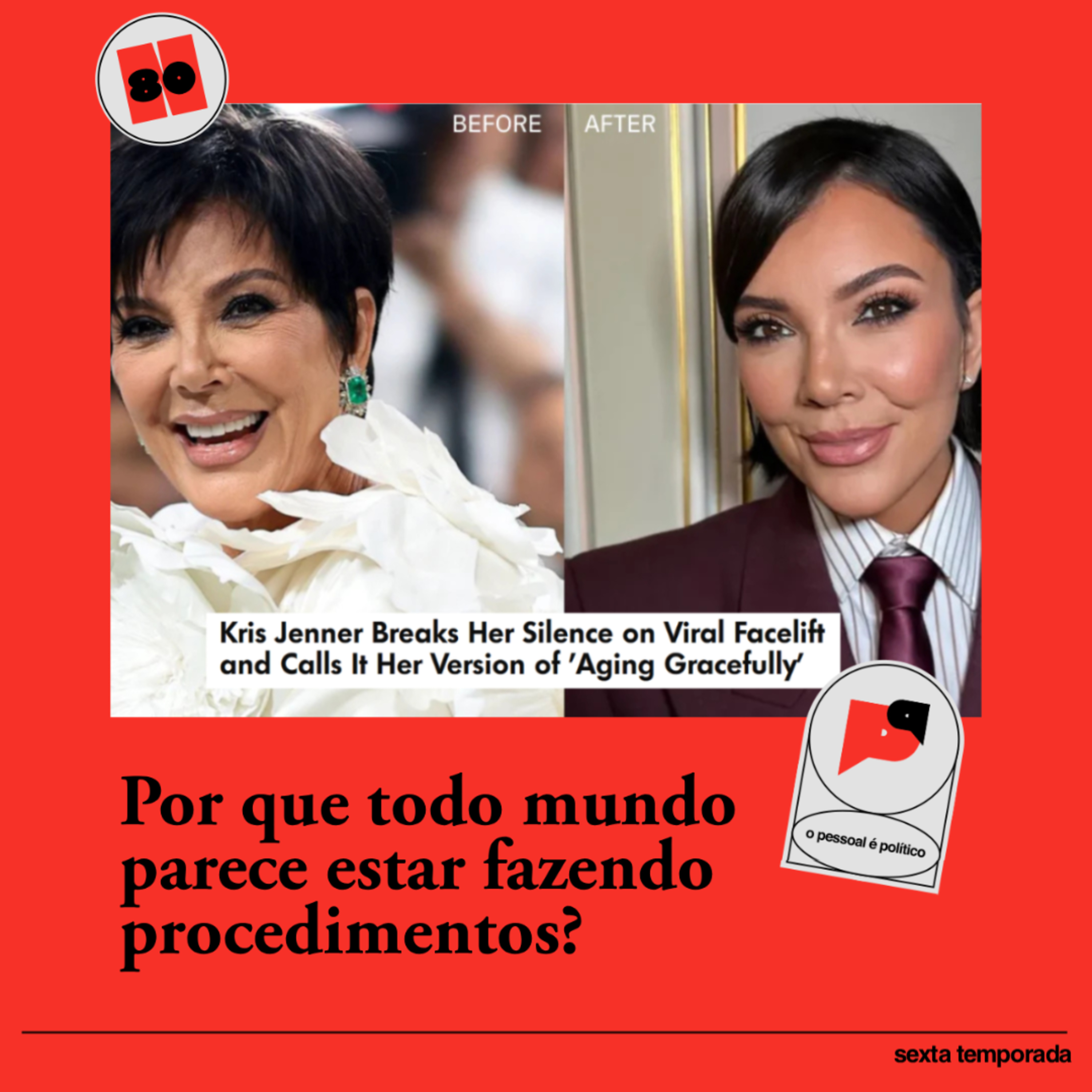 #80: Por que todo mundo parece estar fazendo procedimentos?