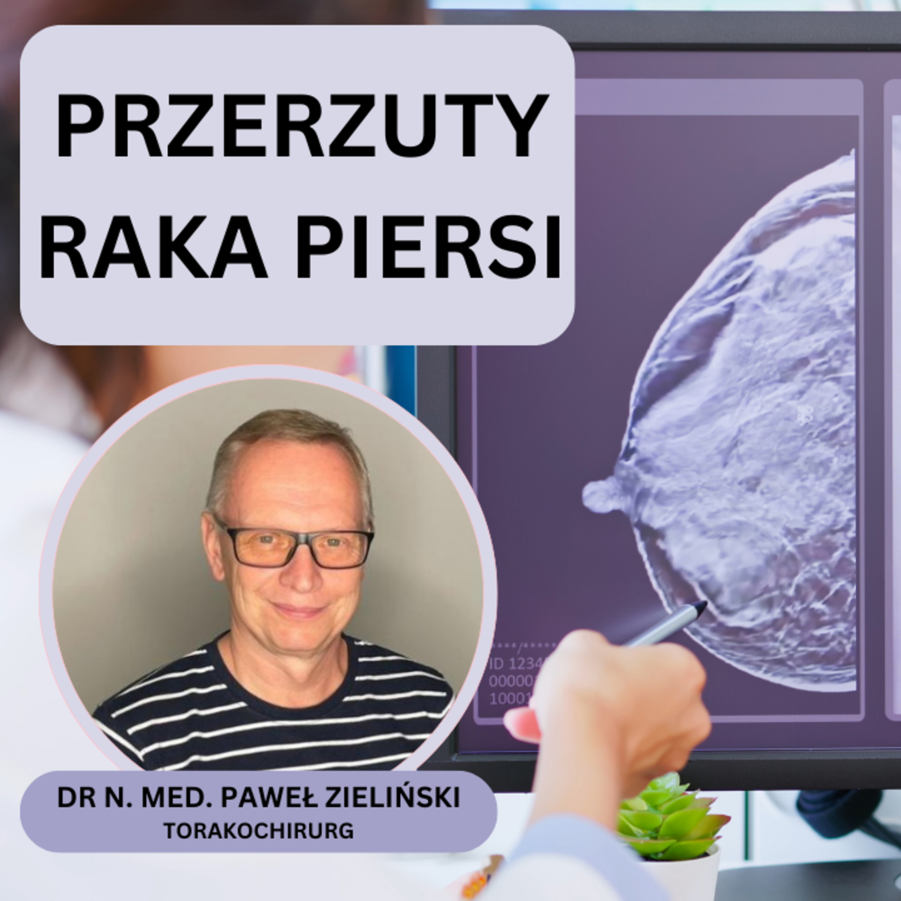 Odcinek 146. Przerzuty raka piersi do płuc. Diagnostyka. Część 1. episode artwork