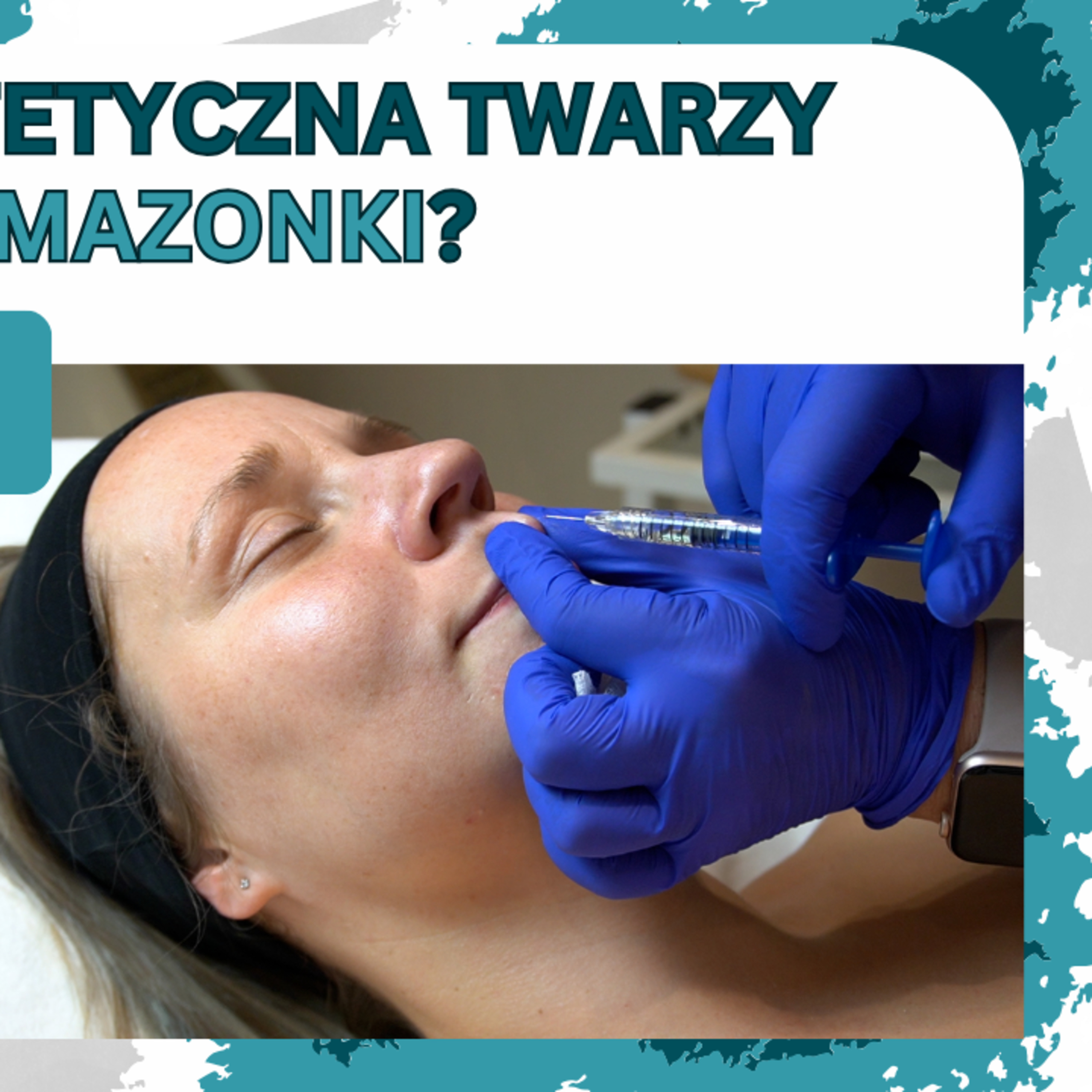 Odcinek 149. Zabiegi medycyny estetycznej dla amazonki. Czy naprawdę musimy czekać 5 lat? episode artwork