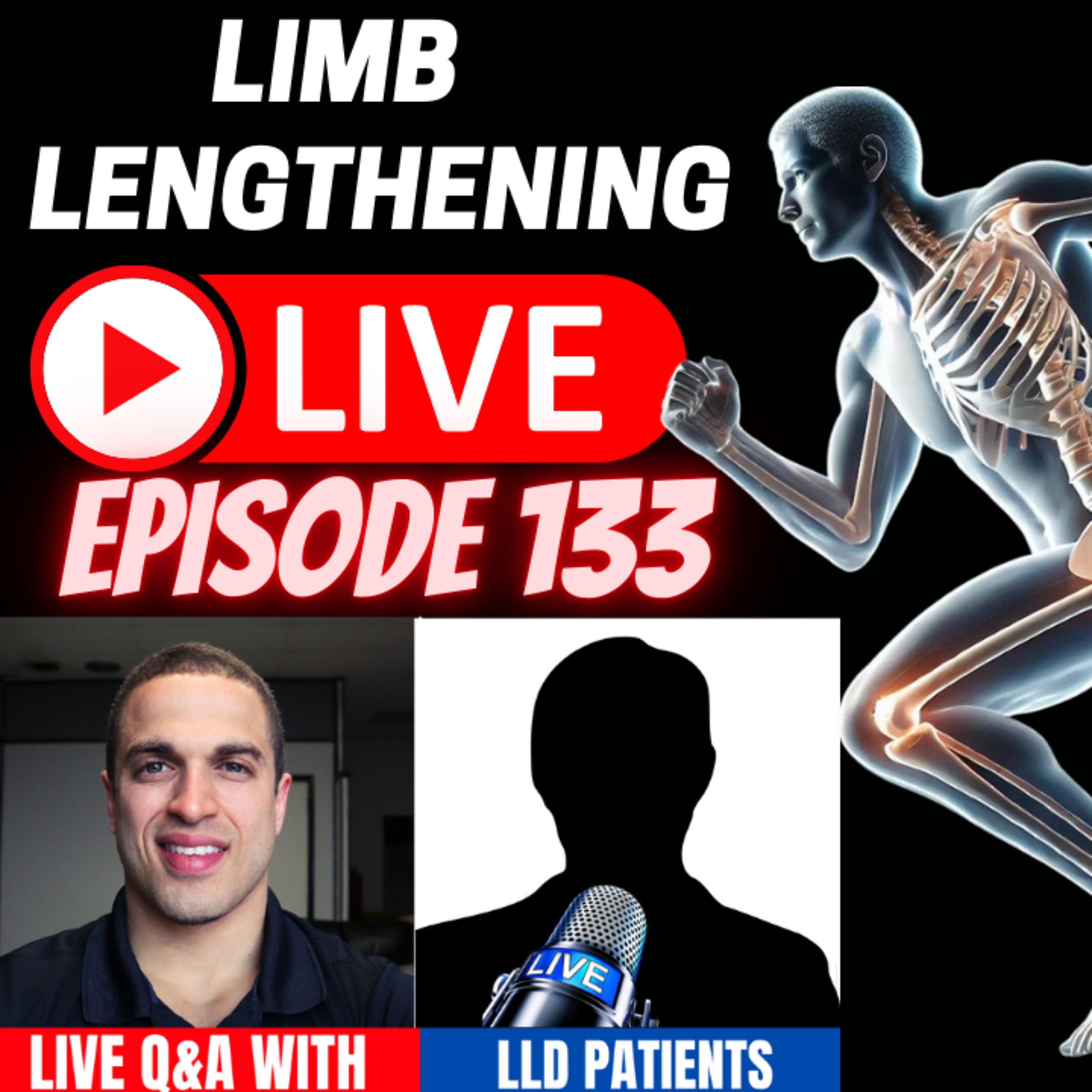 Limb Length LIVE Episode 133 LLD - Discrepancy Roundtable