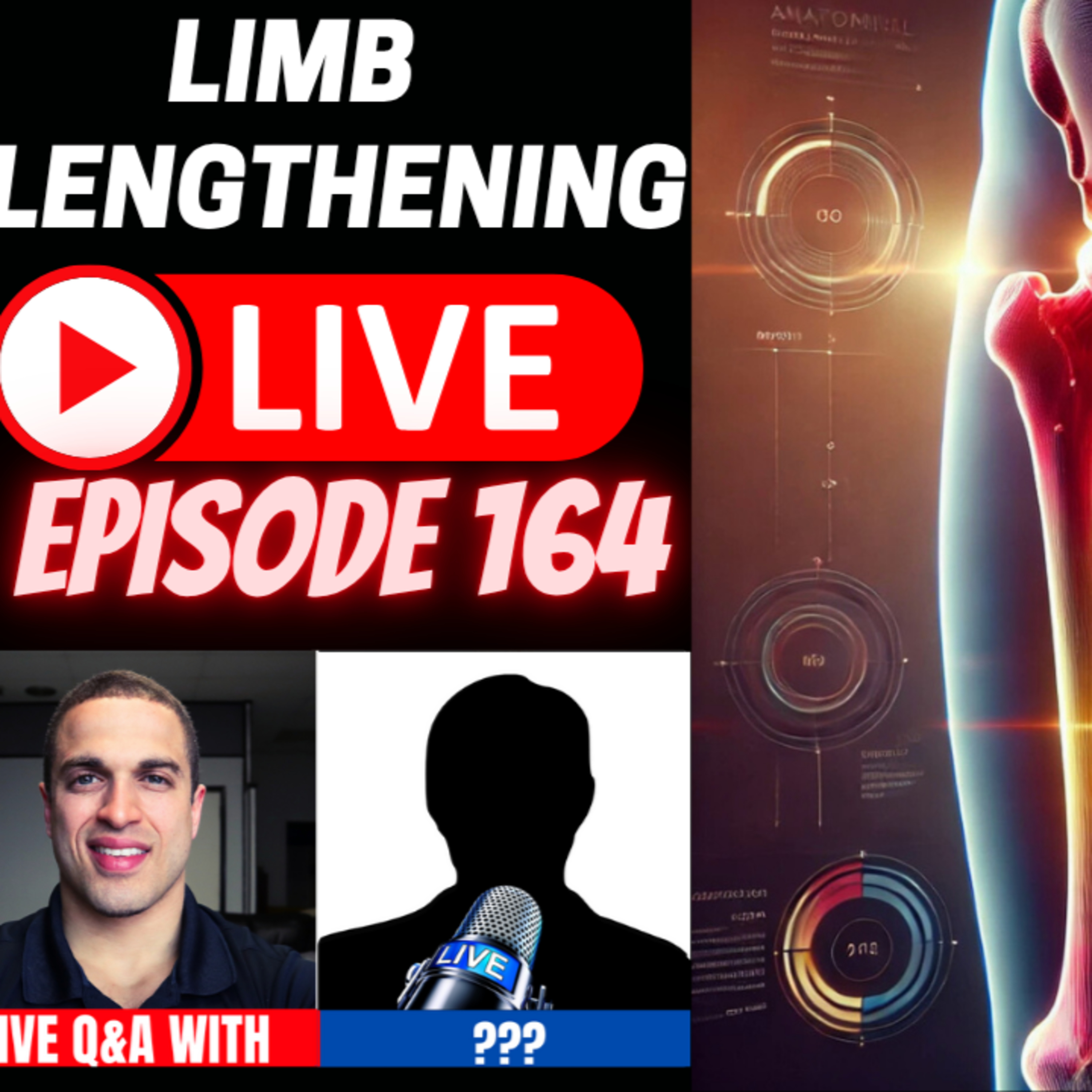 Limb Lengthening LIVE Episode 164 - Patient Updates