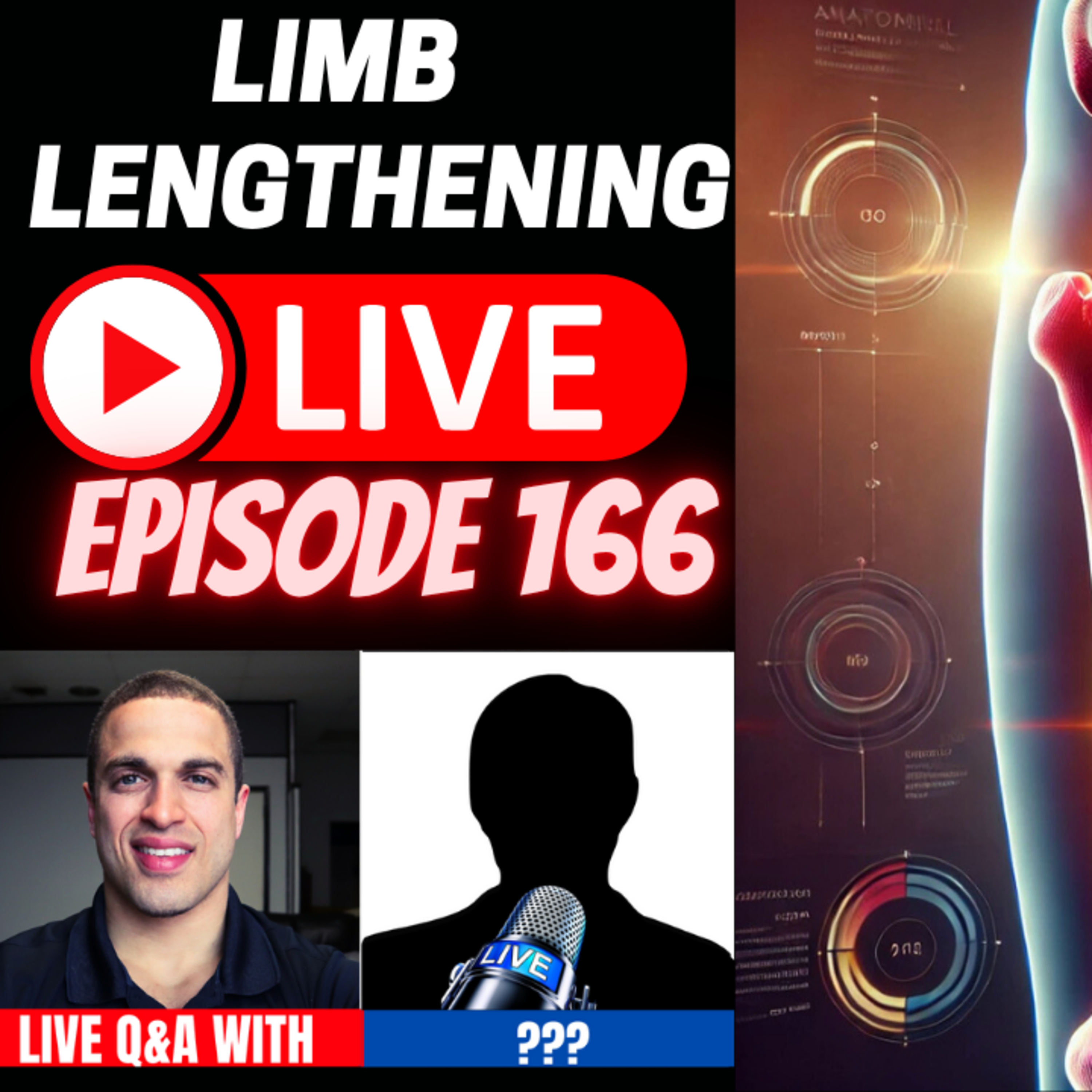Limb Lengthening Podcast
