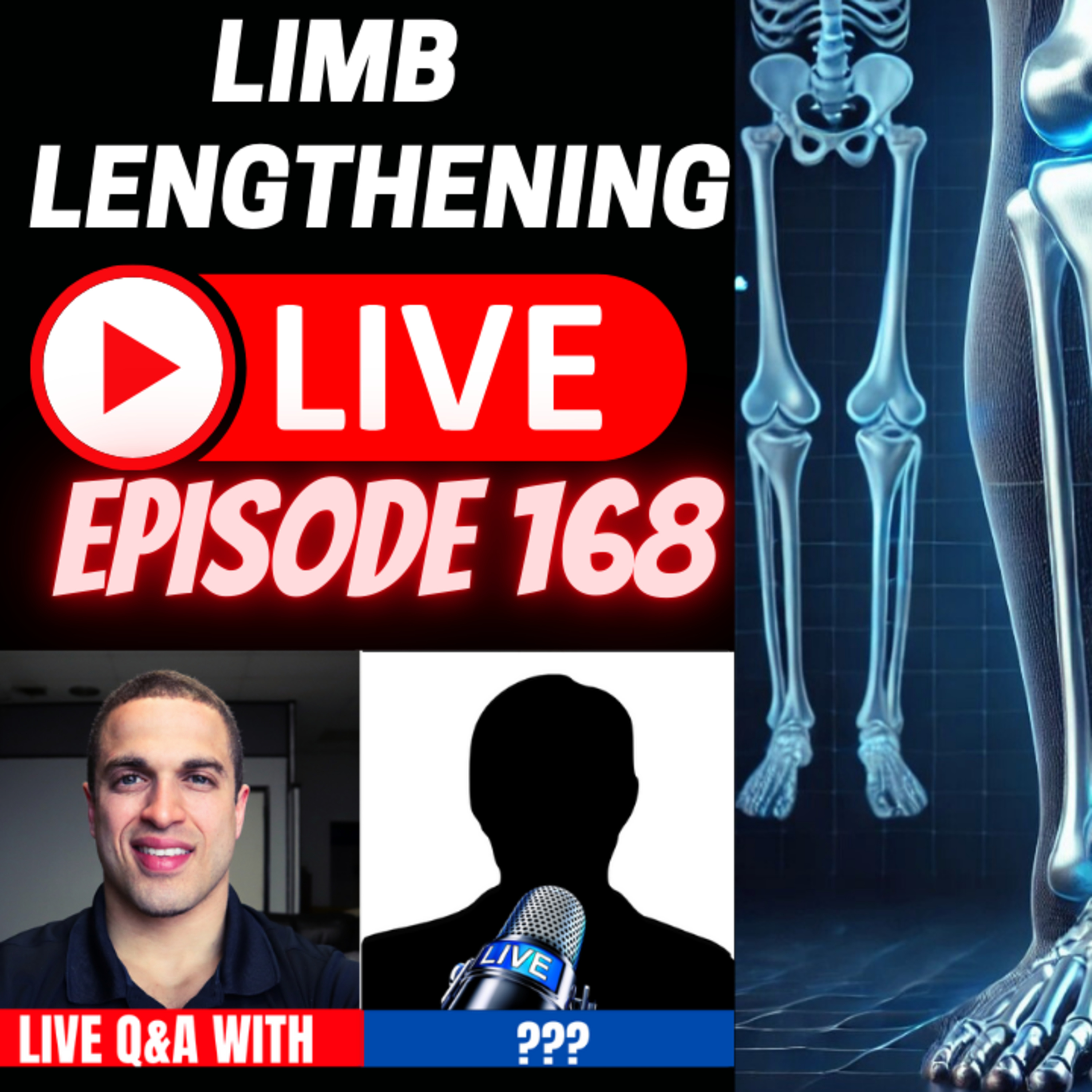 Limb Lengthening LIVE Episode 168 - Nailed Legs, Aaron, Aiden, MD, CodeRedMan