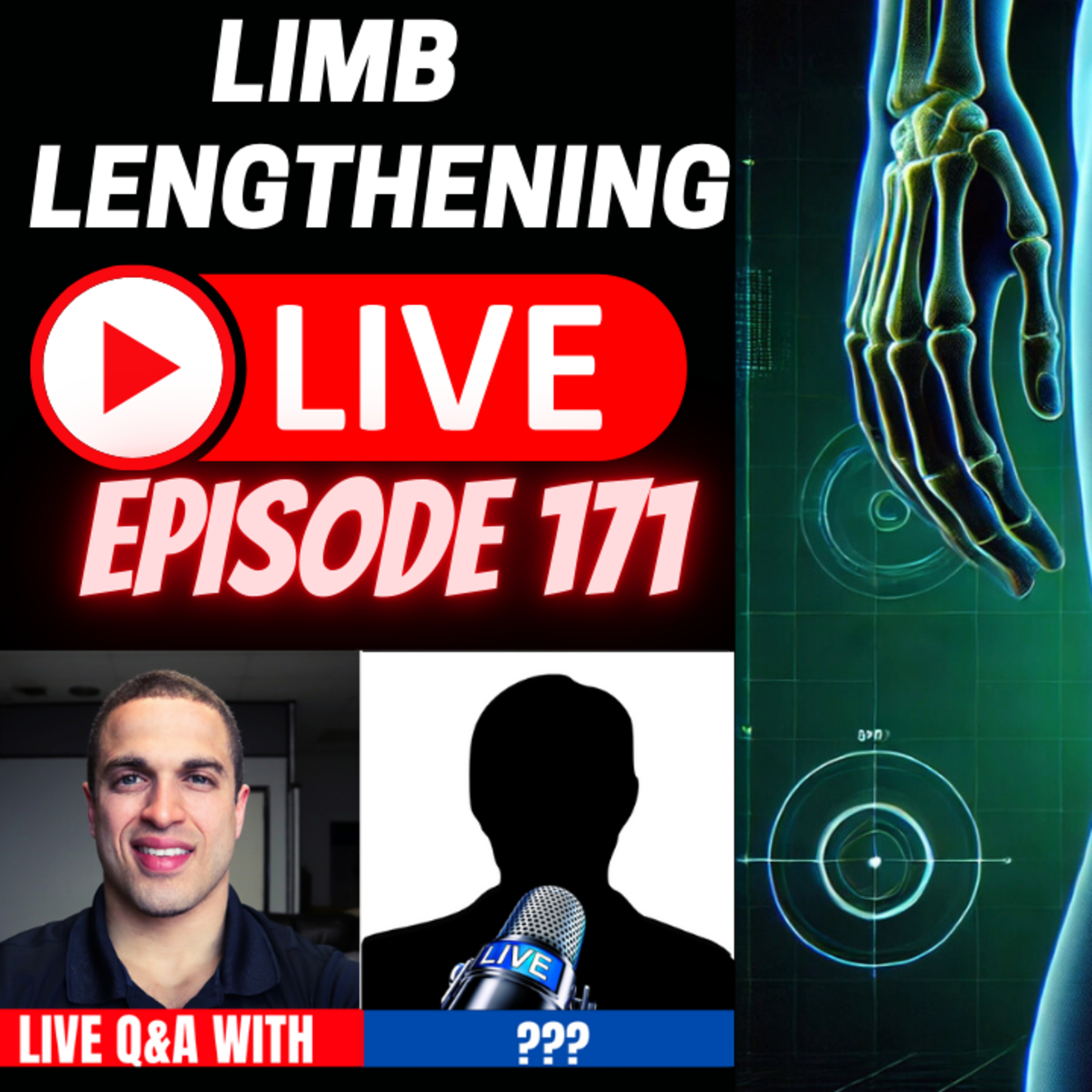 Limb Lengthening LIVE Ep. 171 – What to expect Right After Limb Lengthening Surgery w/ Noah