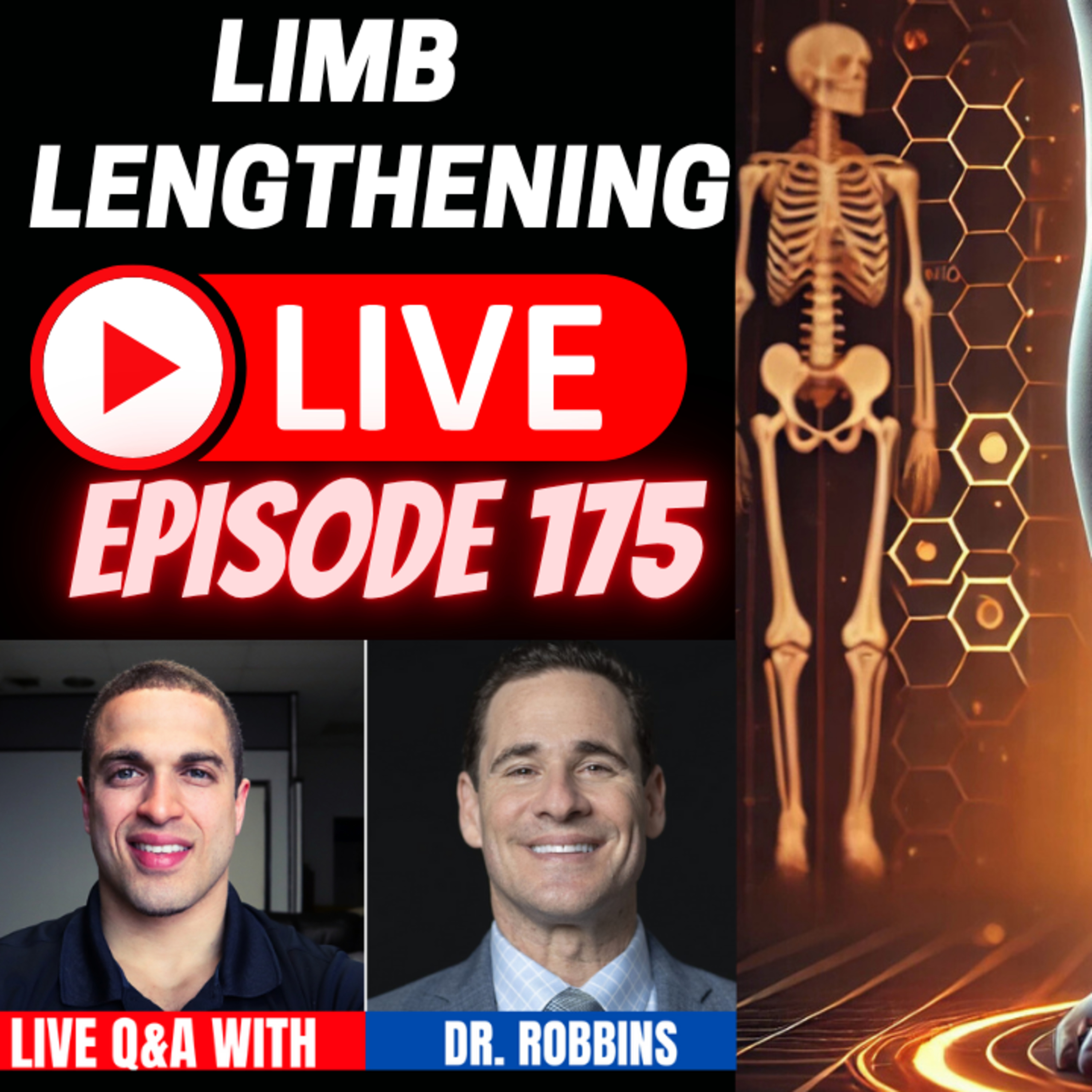 Limb Lengthening Podcast