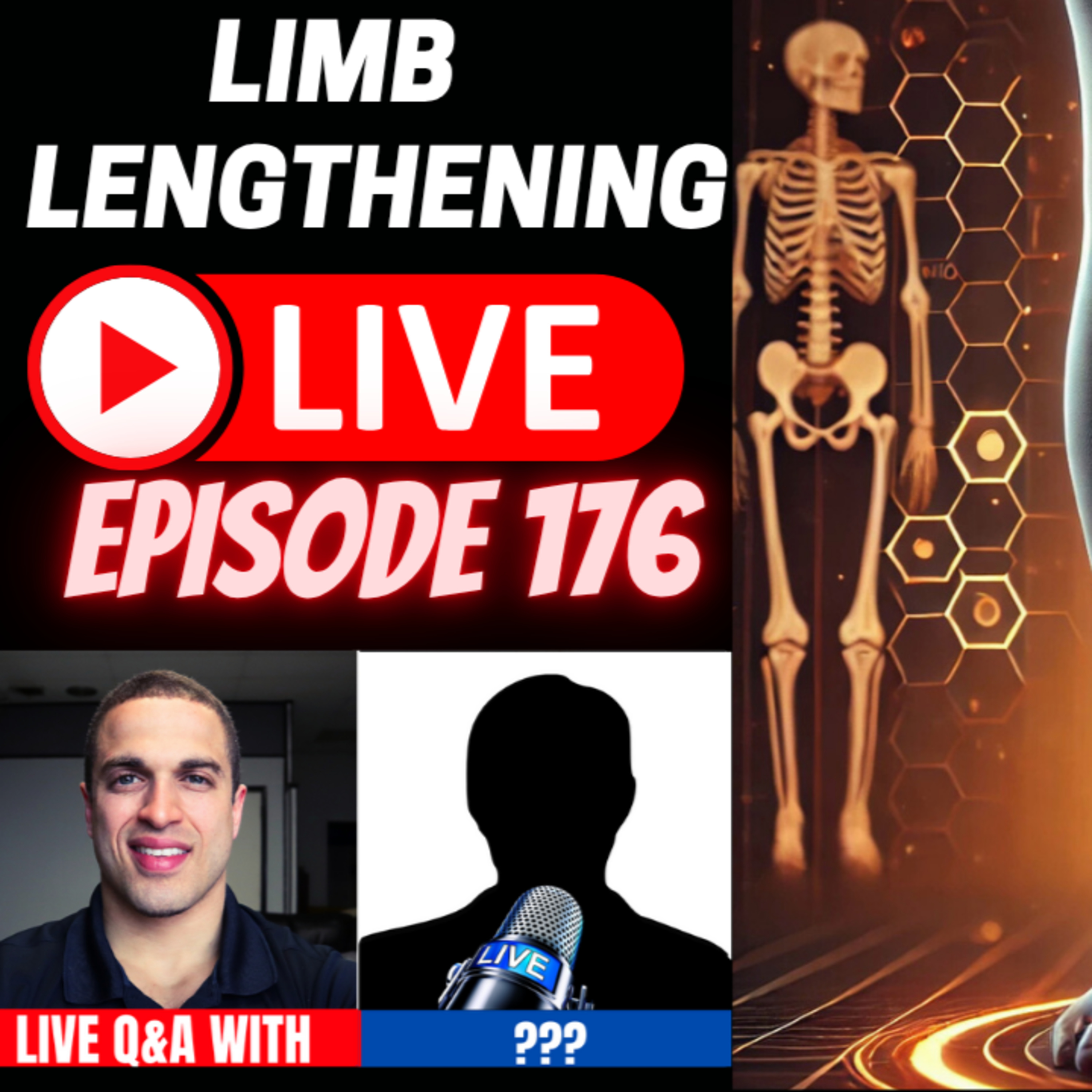Limb Lengthening Podcast