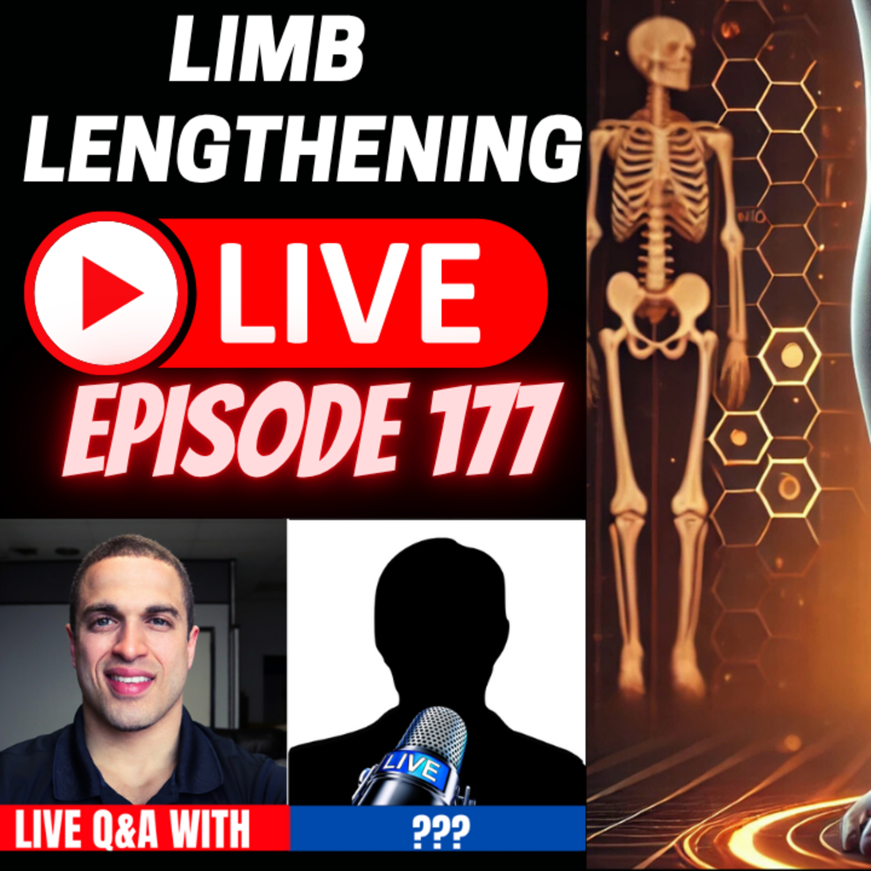 Limb Lengthening Podcast