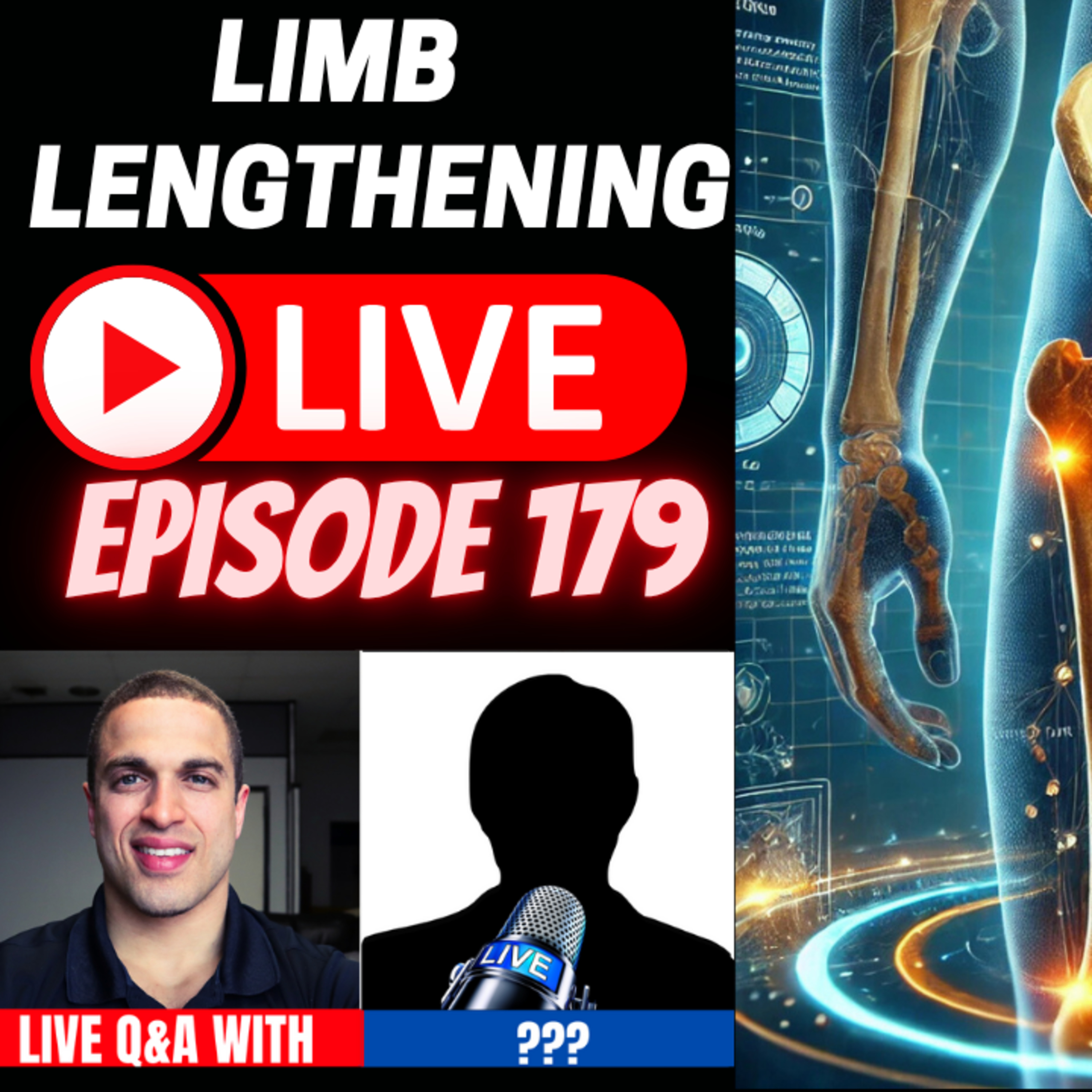 Limb Lengthening Podcast