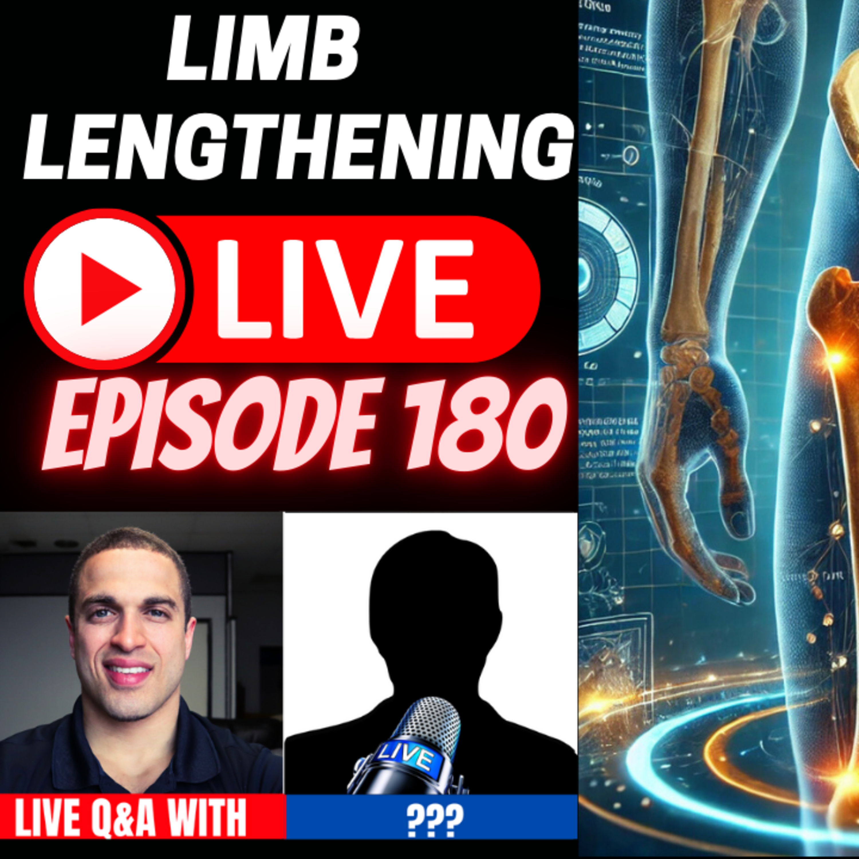 Limb Lengthening Podcast