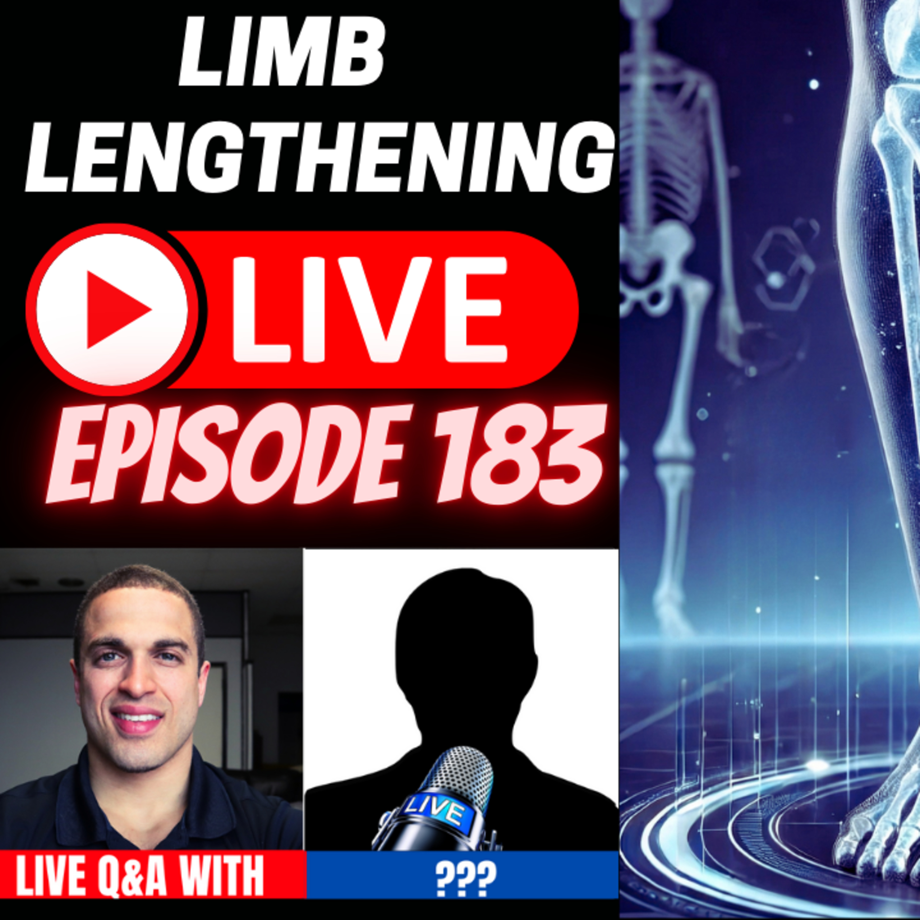 Limb Lengthening Podcast