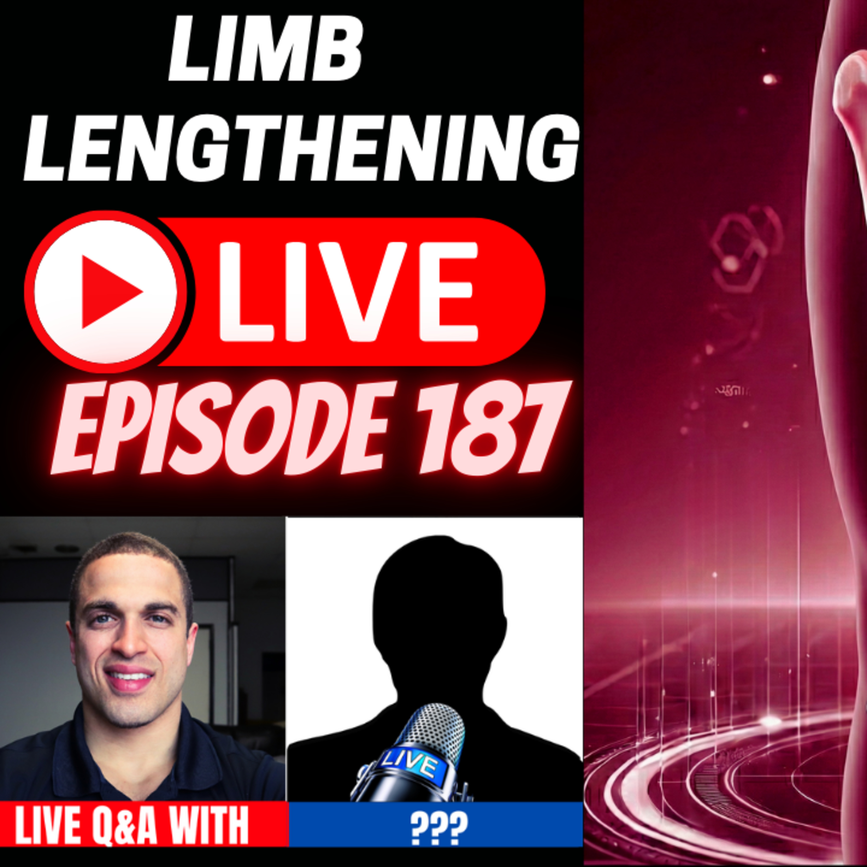 Limb Lengthening Podcast