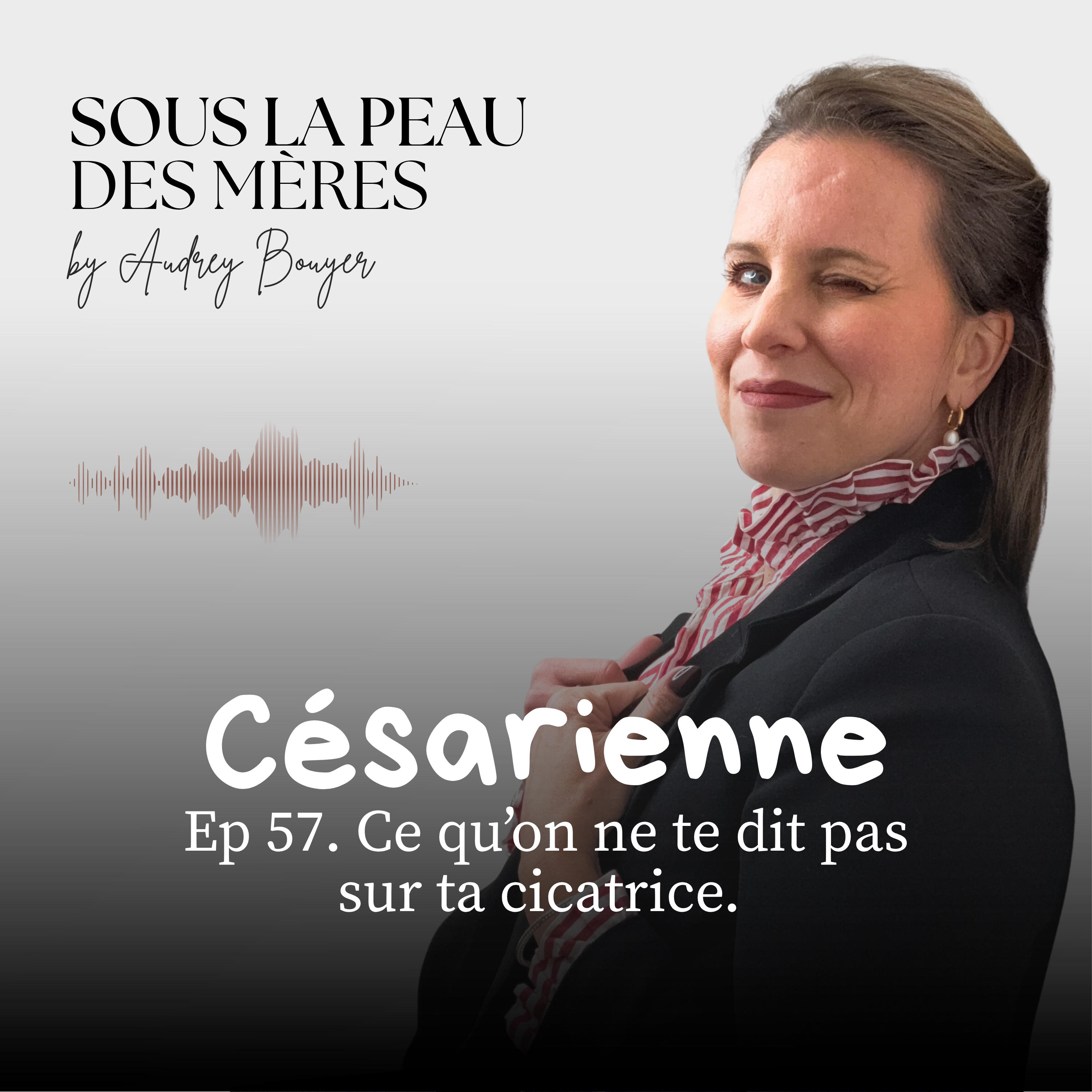 57 . Césarienne : ce qu'on ne te dit pas sur ta cicatrice  episode artwork