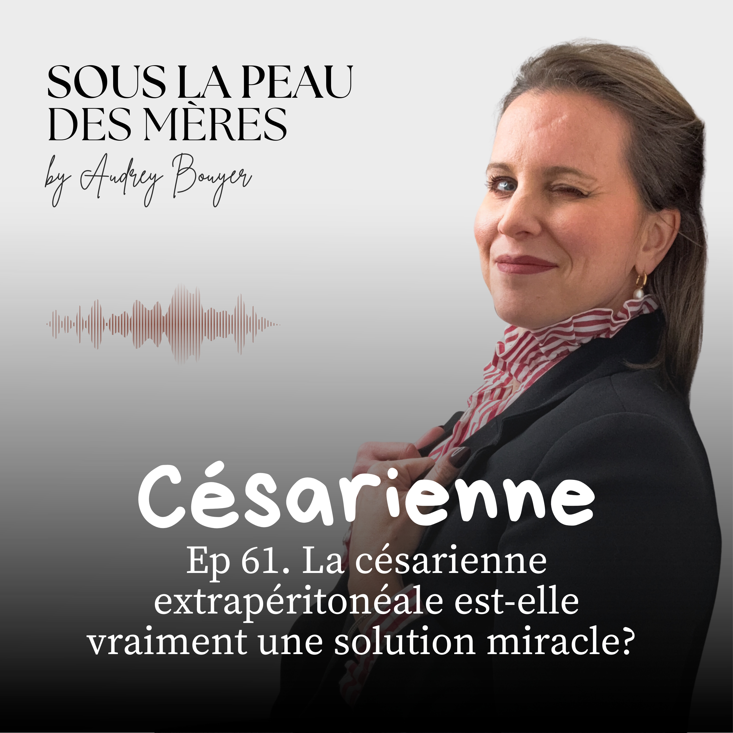 61 . La césarienne extrapéritonéale est-elle vraiment la solution miracle? episode artwork