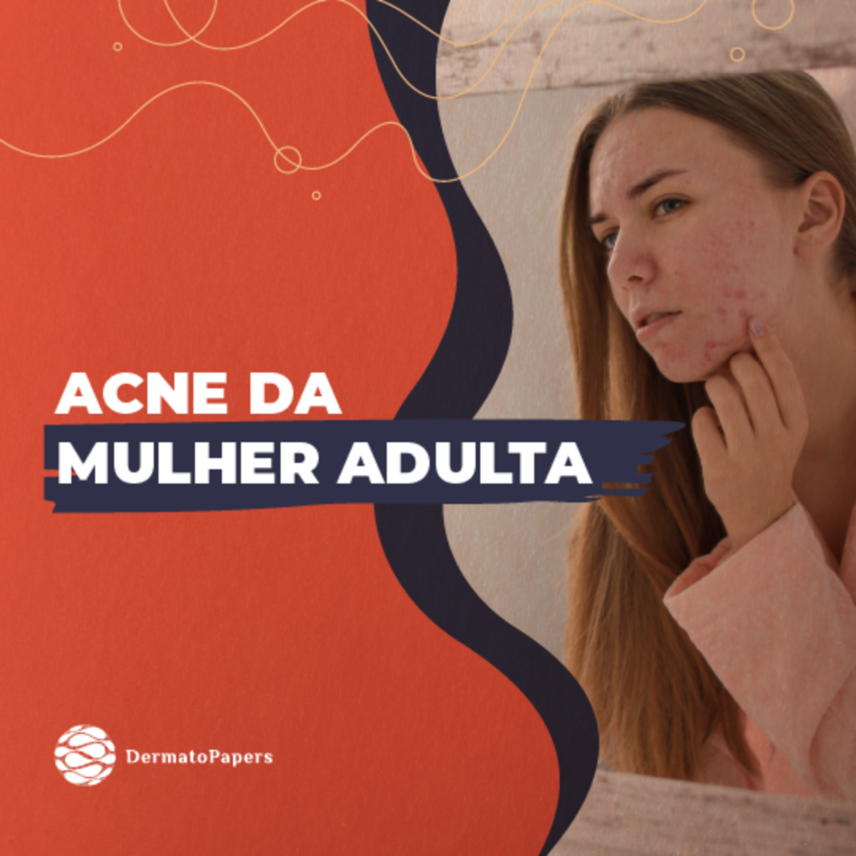#175-Podcast: Acne da Mulher Adulta episode artwork