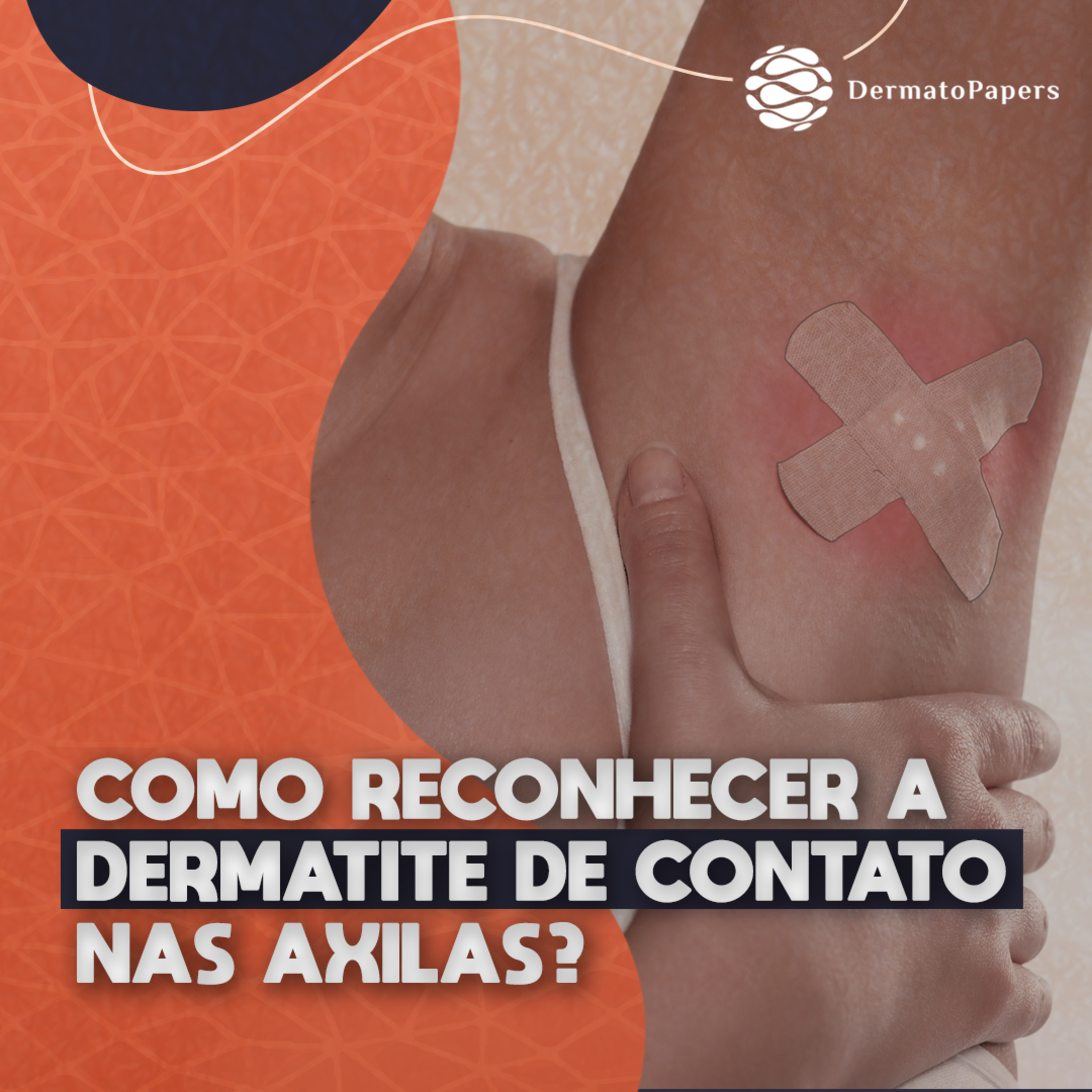 #260-Lesão em axila: pensar na possibilidade de dermatite de contato episode artwork