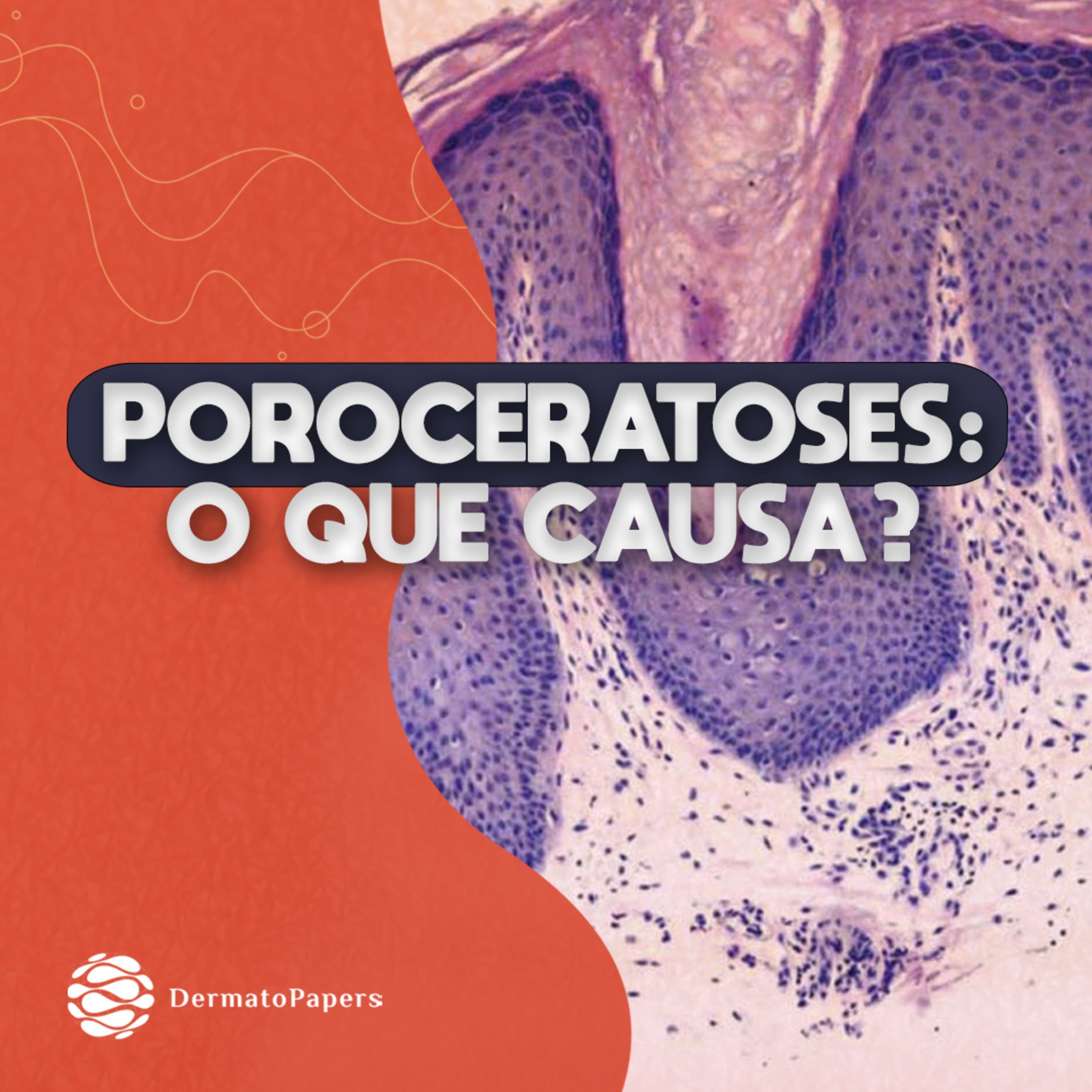 #261-O QUE PROVOCA AS POROCERATOSES? episode artwork