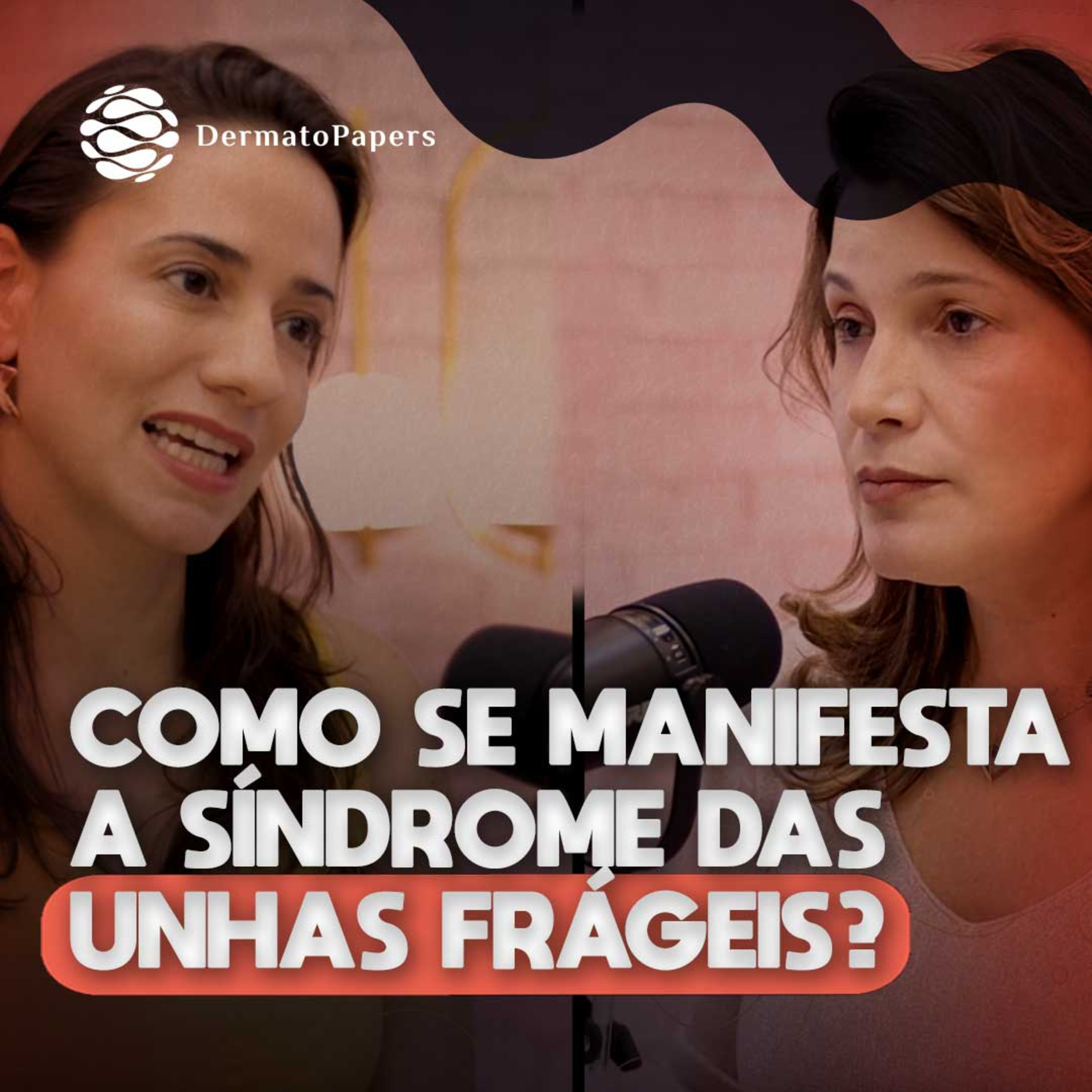 #294-Quais os aspectos clínicos da Síndrome das unhas frágeis? episode artwork
