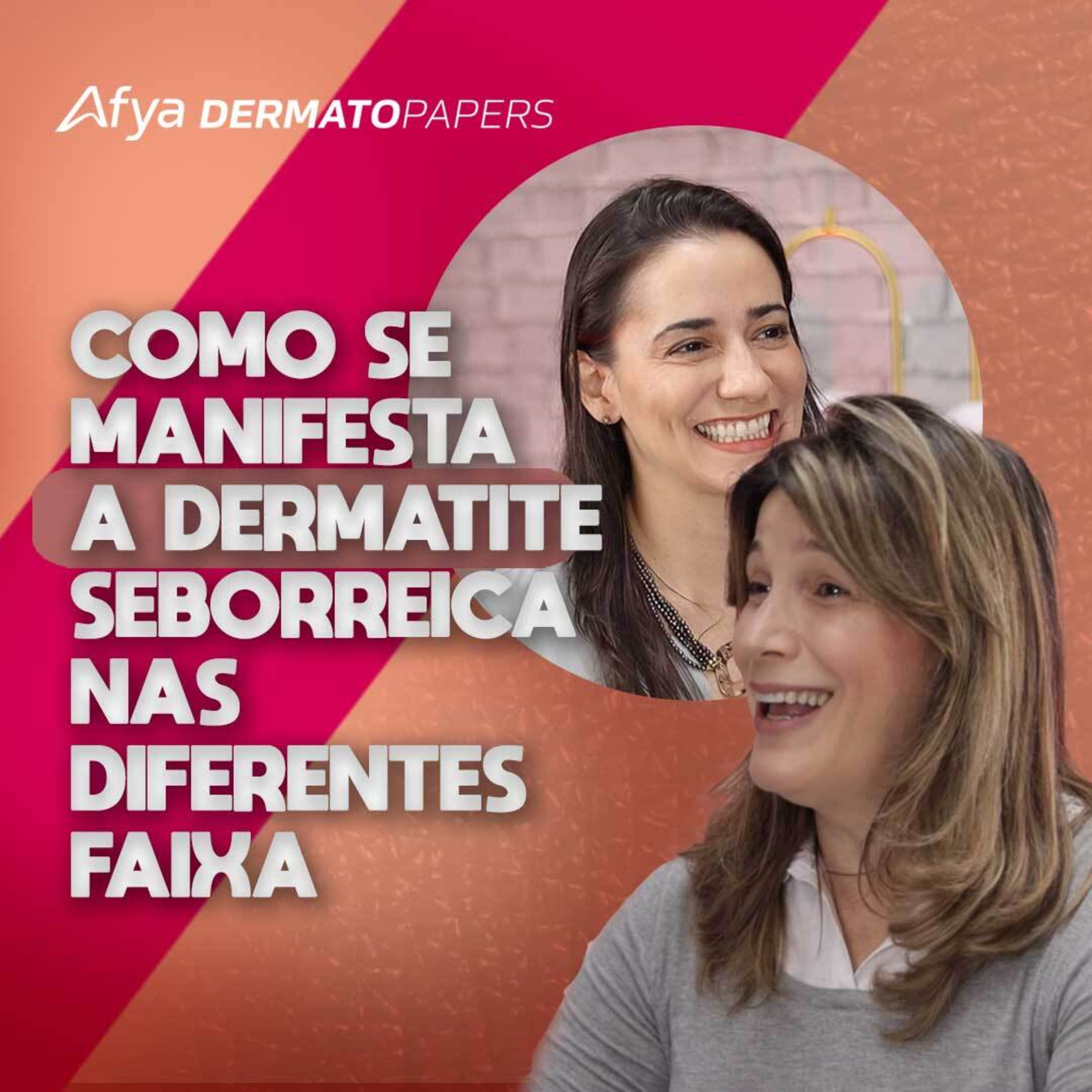 #338-Como se manifesta clinicamente a Dermatite Seborreica e a caspa? episode artwork