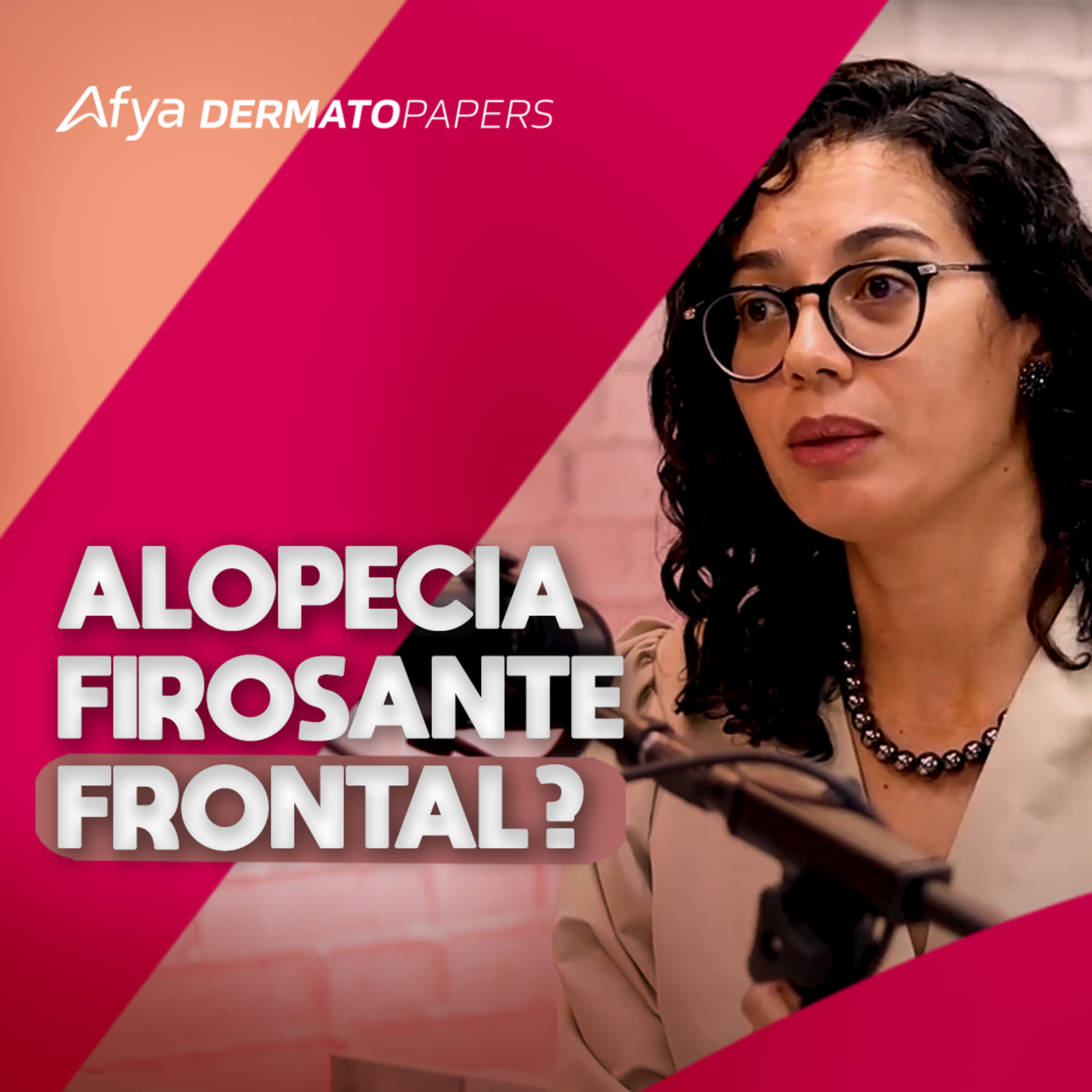 #352-Quando biopsiar um paciente com suspeita de Alopecia Fibrosante Frontal? episode artwork