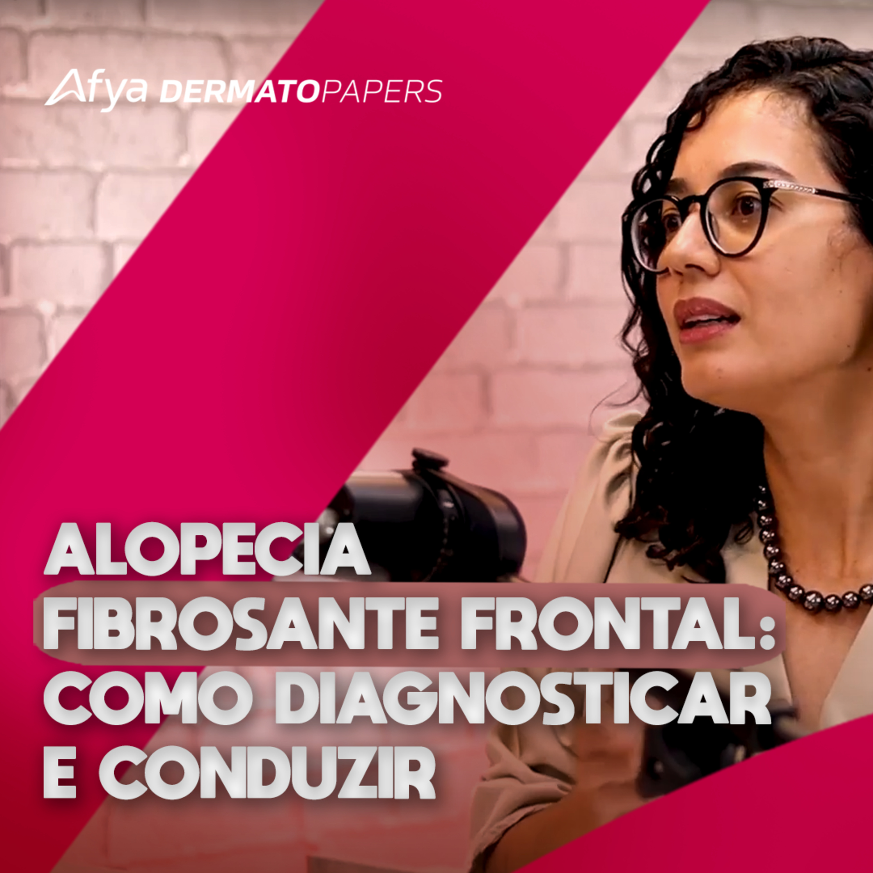 #362-Implante capilar é uma opção terapêutica para a Alopecia Fibrosante Frontal? episode artwork
