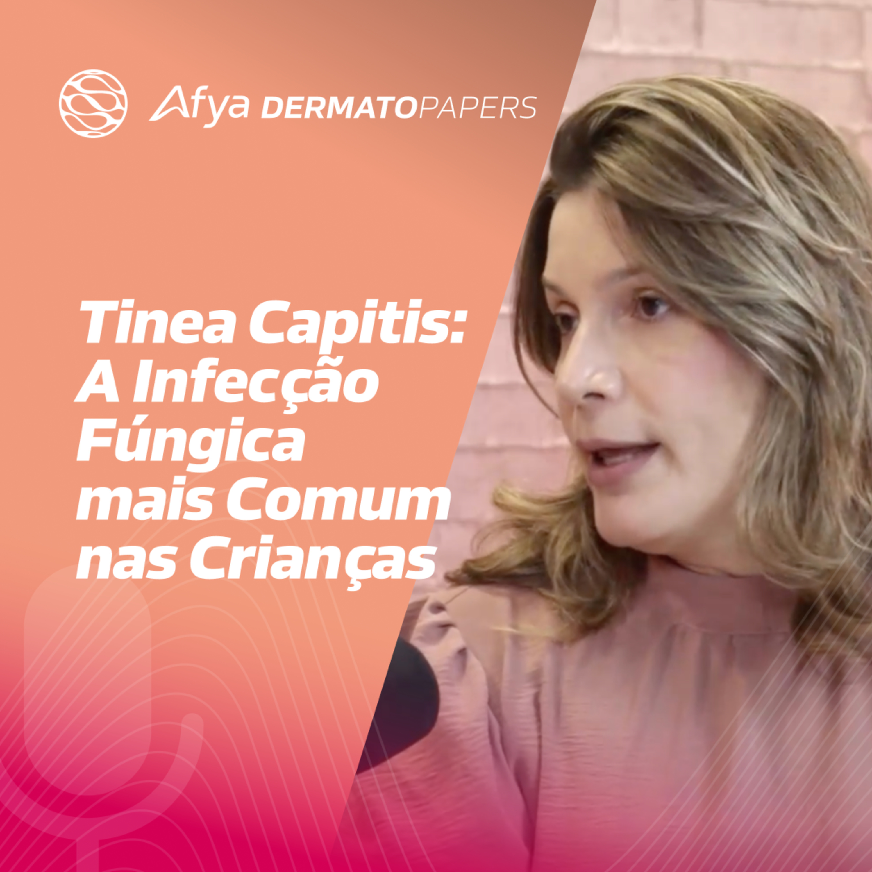 Tinea capitis: a infecção fúngica mais comum nas crianças episode artwork