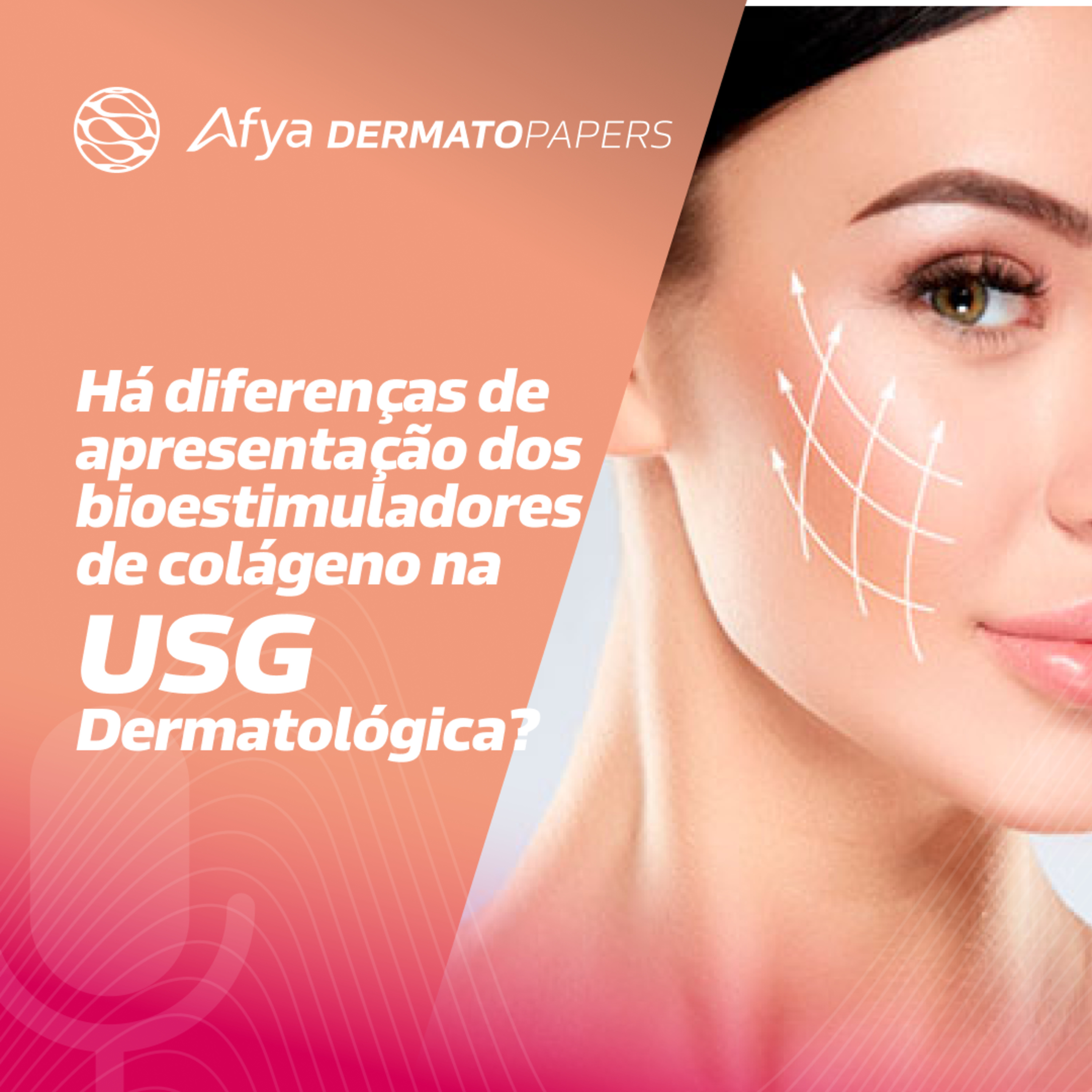 Como os bioestimuladores de colágeno se apresentam na imagem da USG? episode artwork