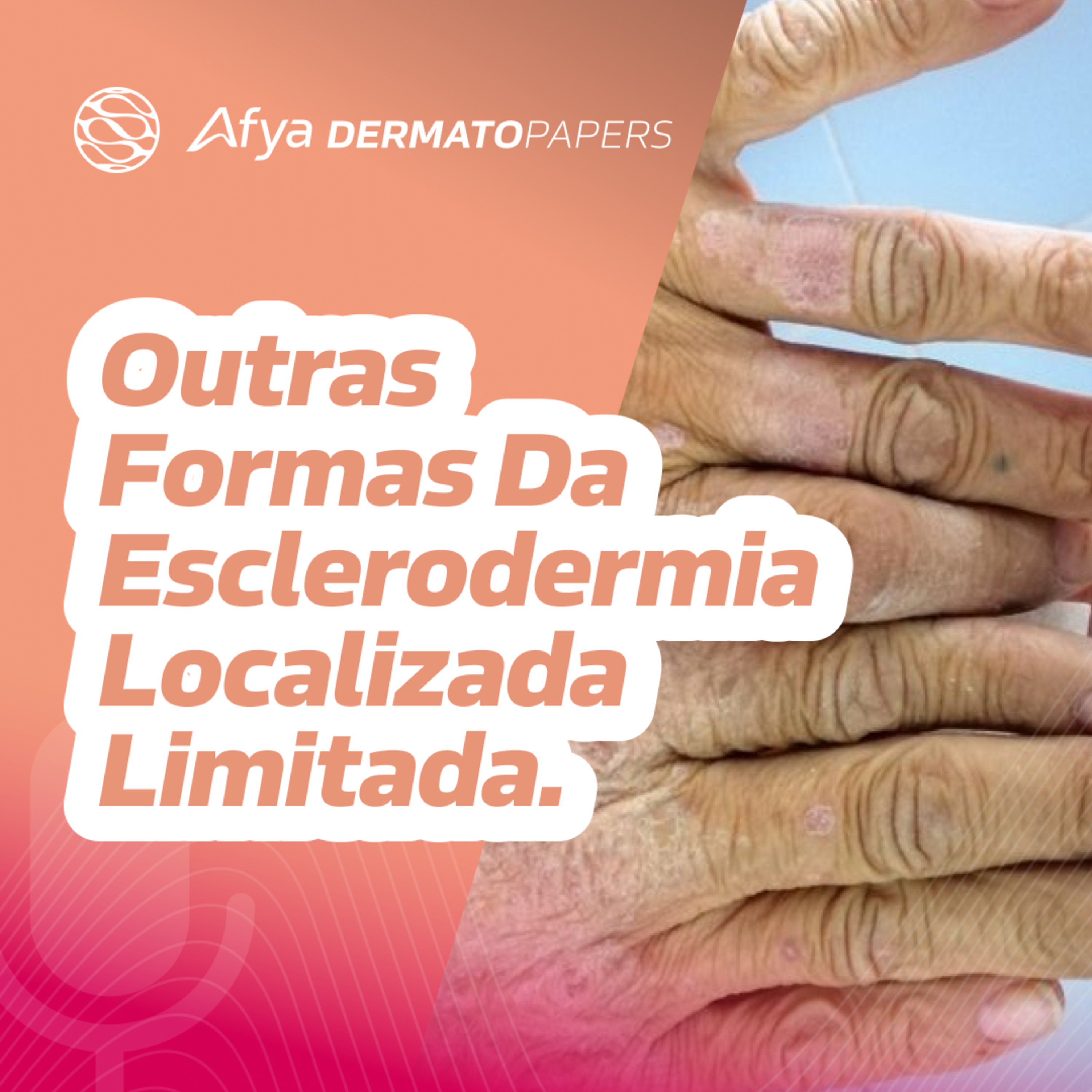 Quais as outras manifestações clínicas da esclerodermia localizada limitada? episode artwork