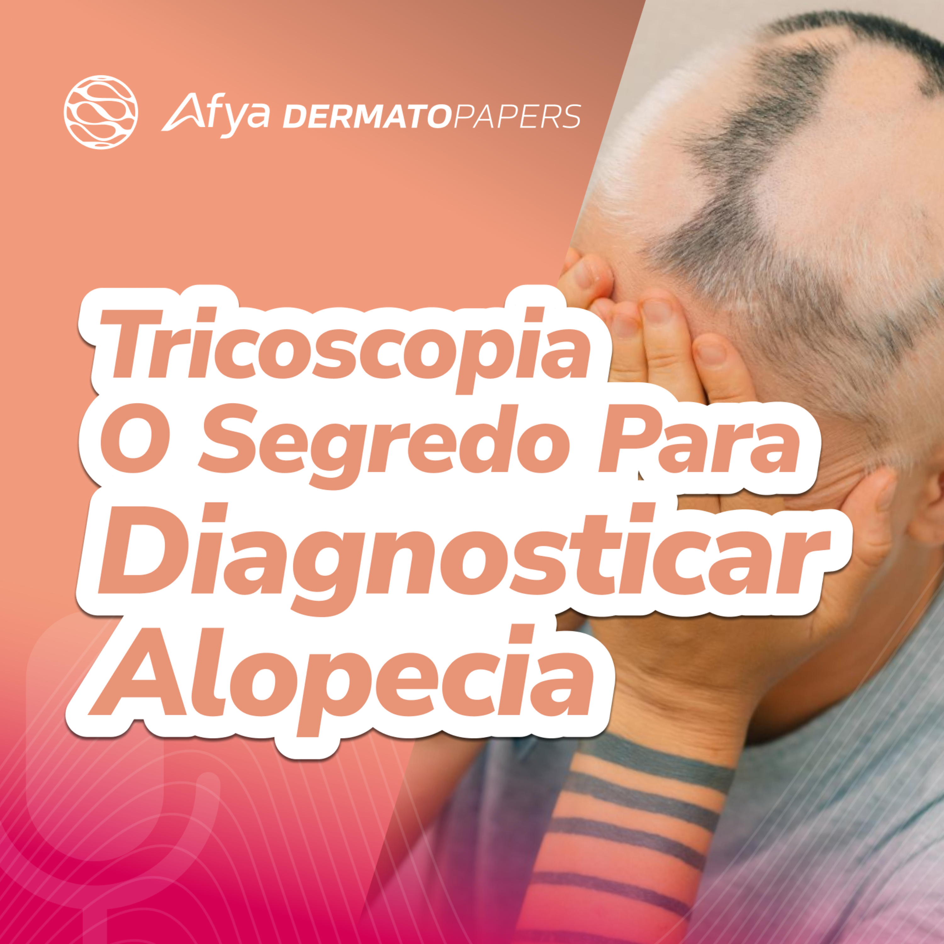 Qual o papel da tricoscopia no diagnóstico diferencial entre AGA, AFF e outras formas de alopecia? episode artwork