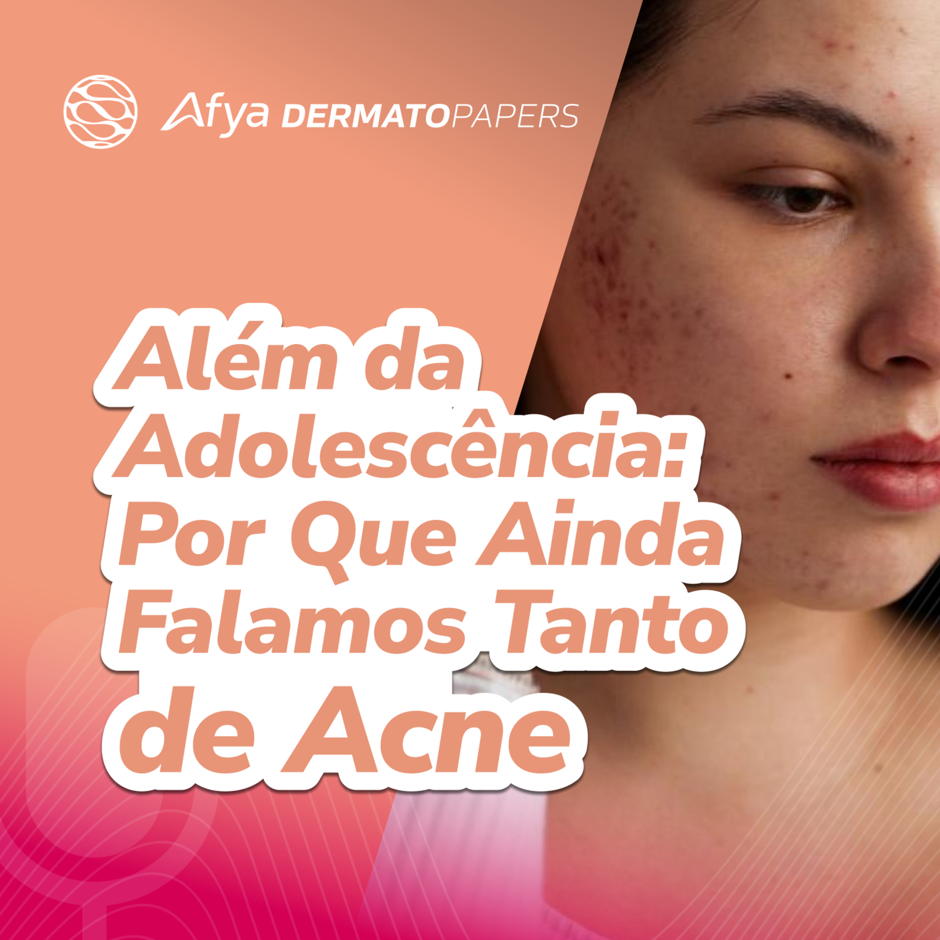 Além da adolescência: Por que ainda falamos tanto de acne episode artwork