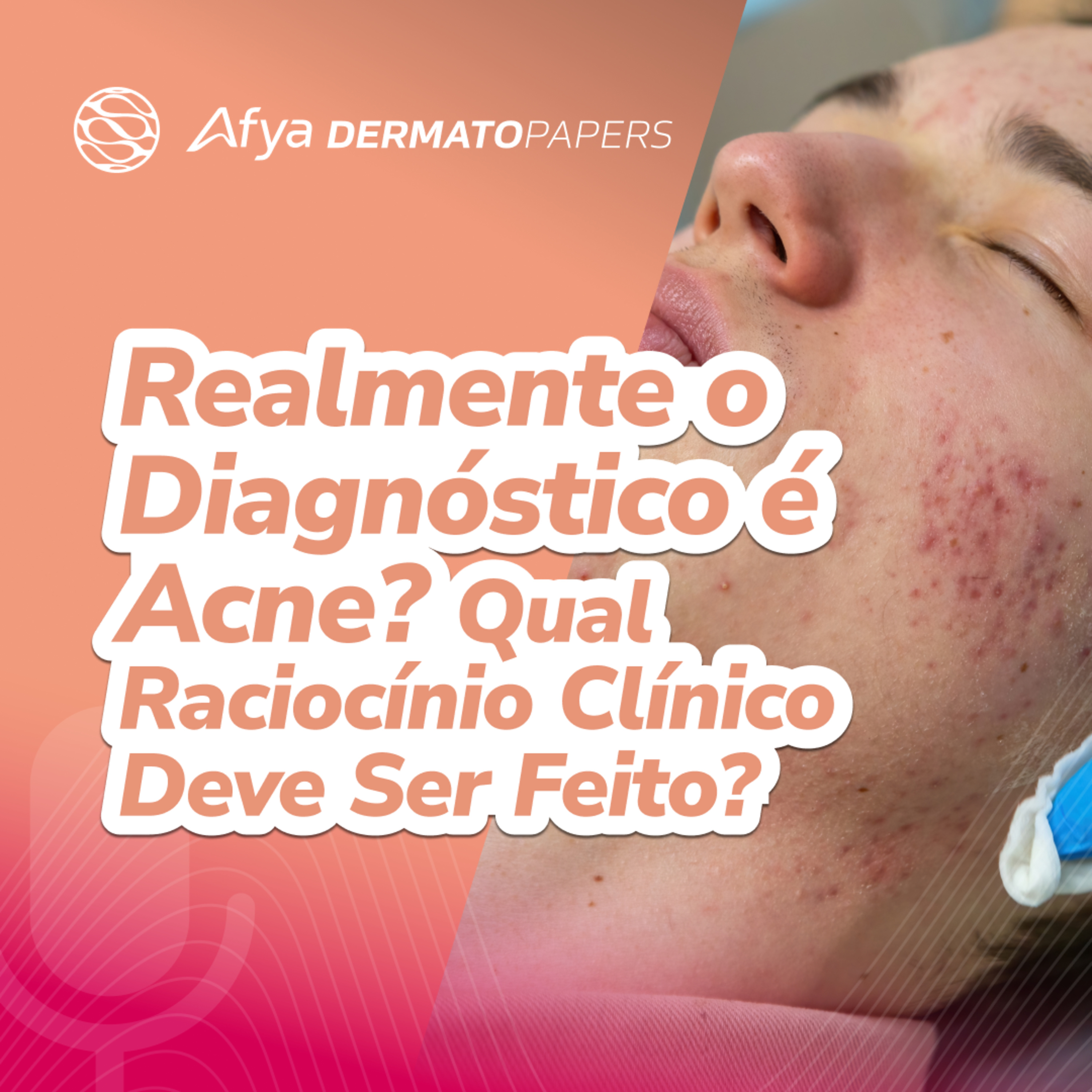 Realmente o diagnóstico é acne? Qual raciocínio clínico deve ser feito? episode artwork