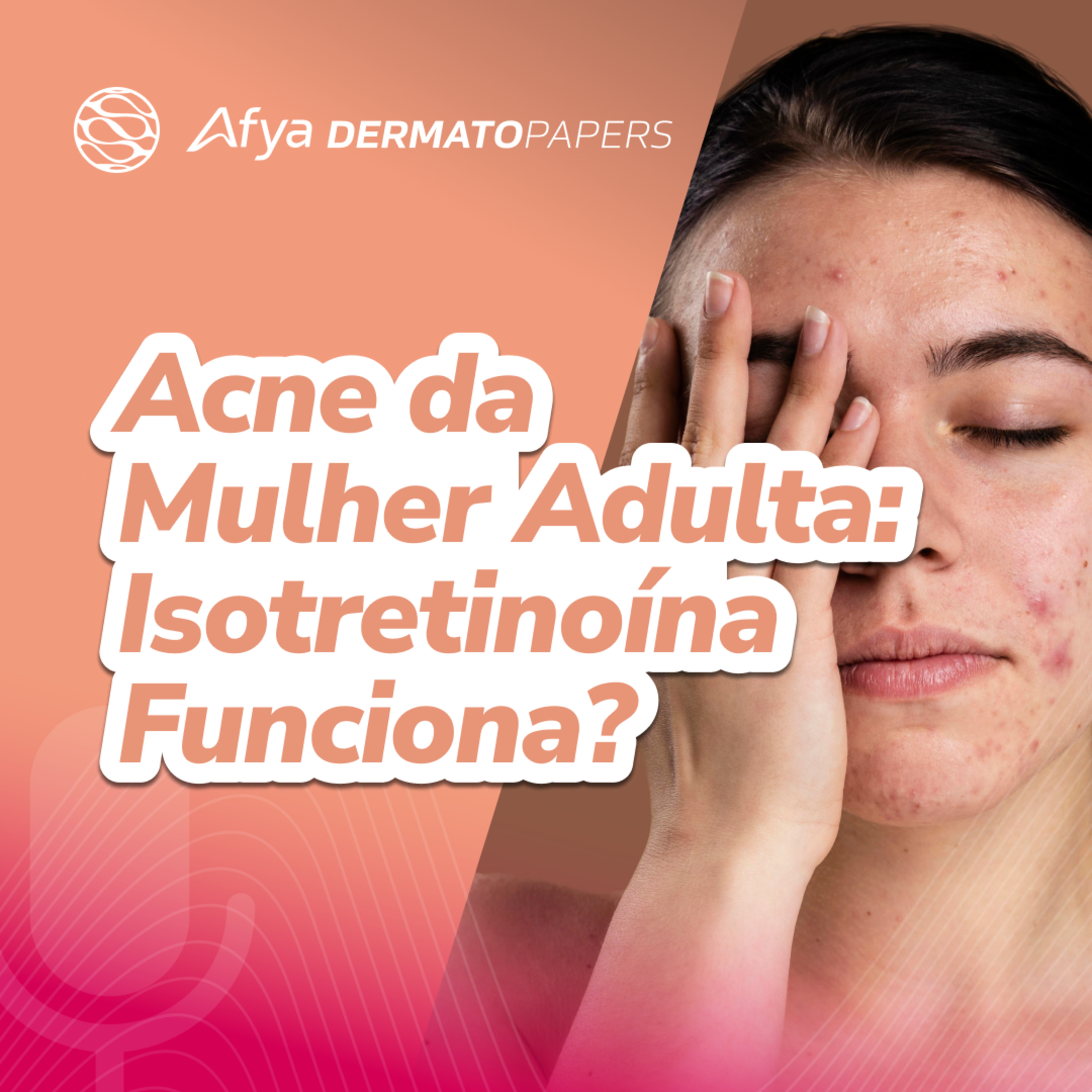 Isotretinoína na acne da mulher adulta: quando indicar e como manejar? episode artwork