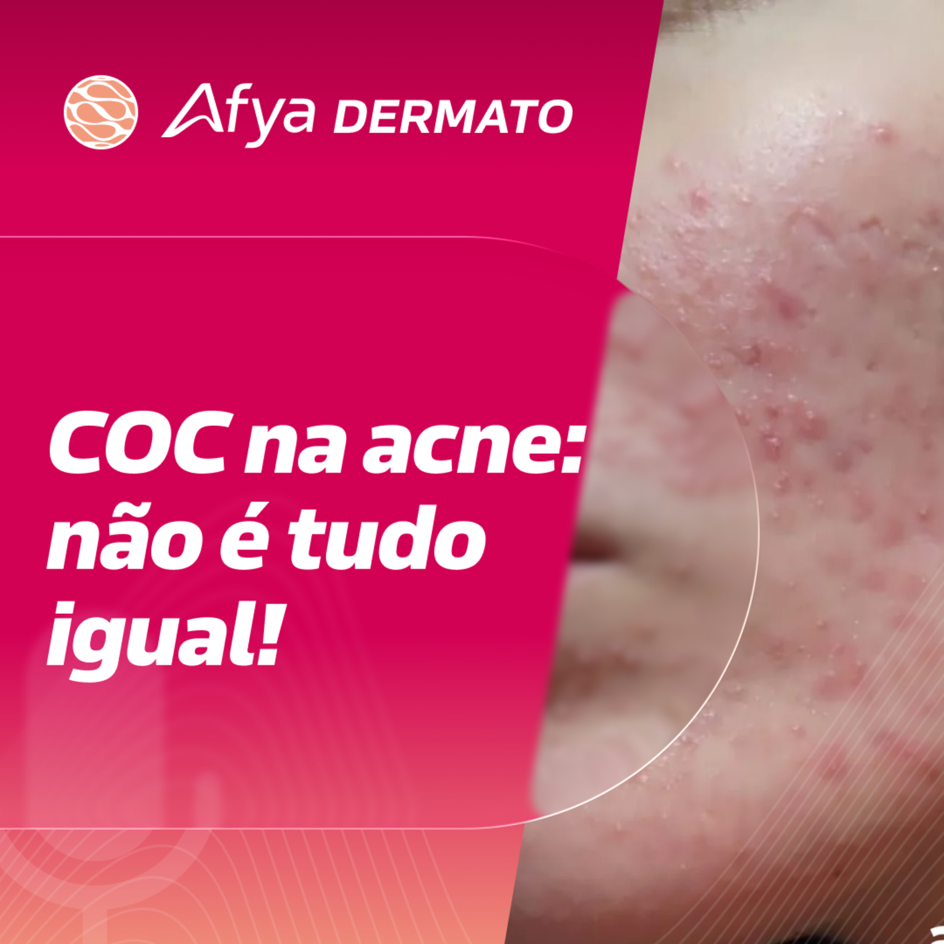COCs: todos funcionam igual? O que a nova revisão revela episode artwork