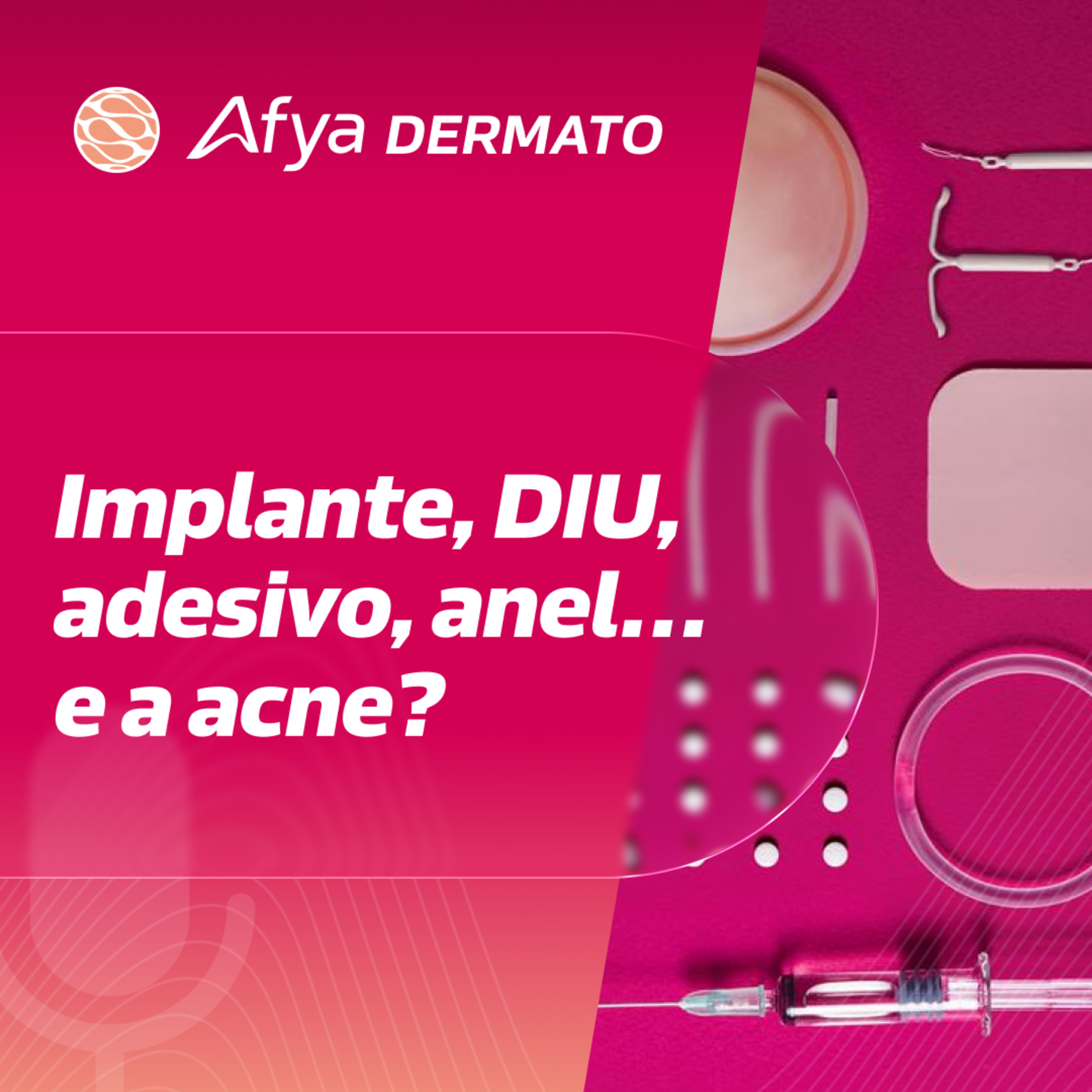 Outros contraceptivos hormonais: ajudam ou pioram a acne? episode artwork