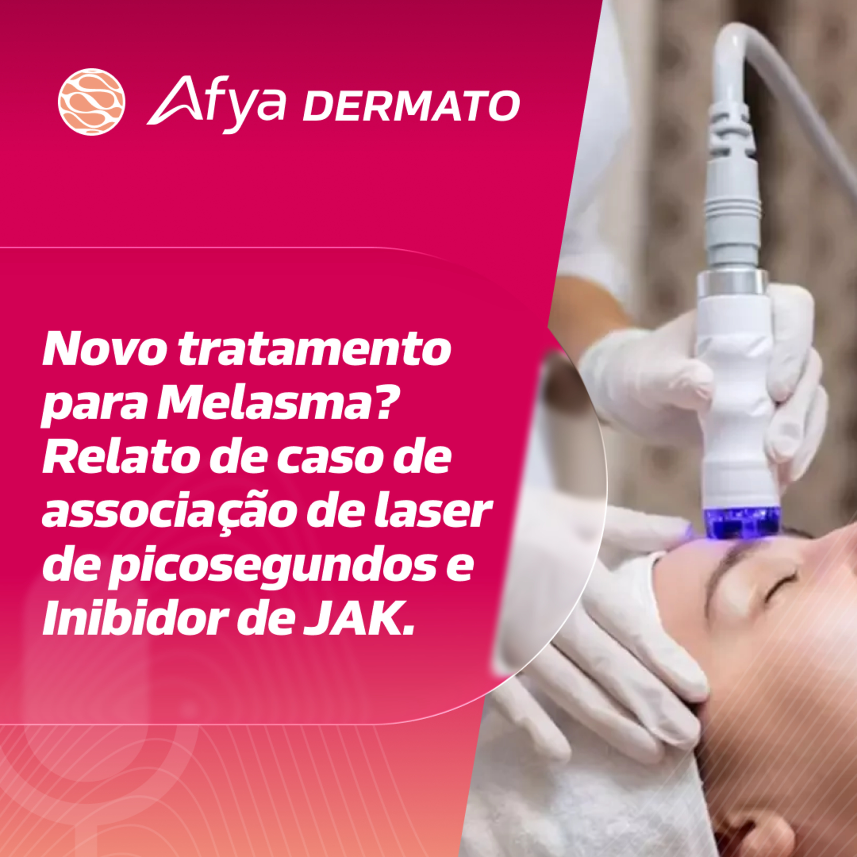 Novo tratamento para Melasma? Relato de caso de associação de laser de picosegundos e Inibidor de JAK. episode artwork
