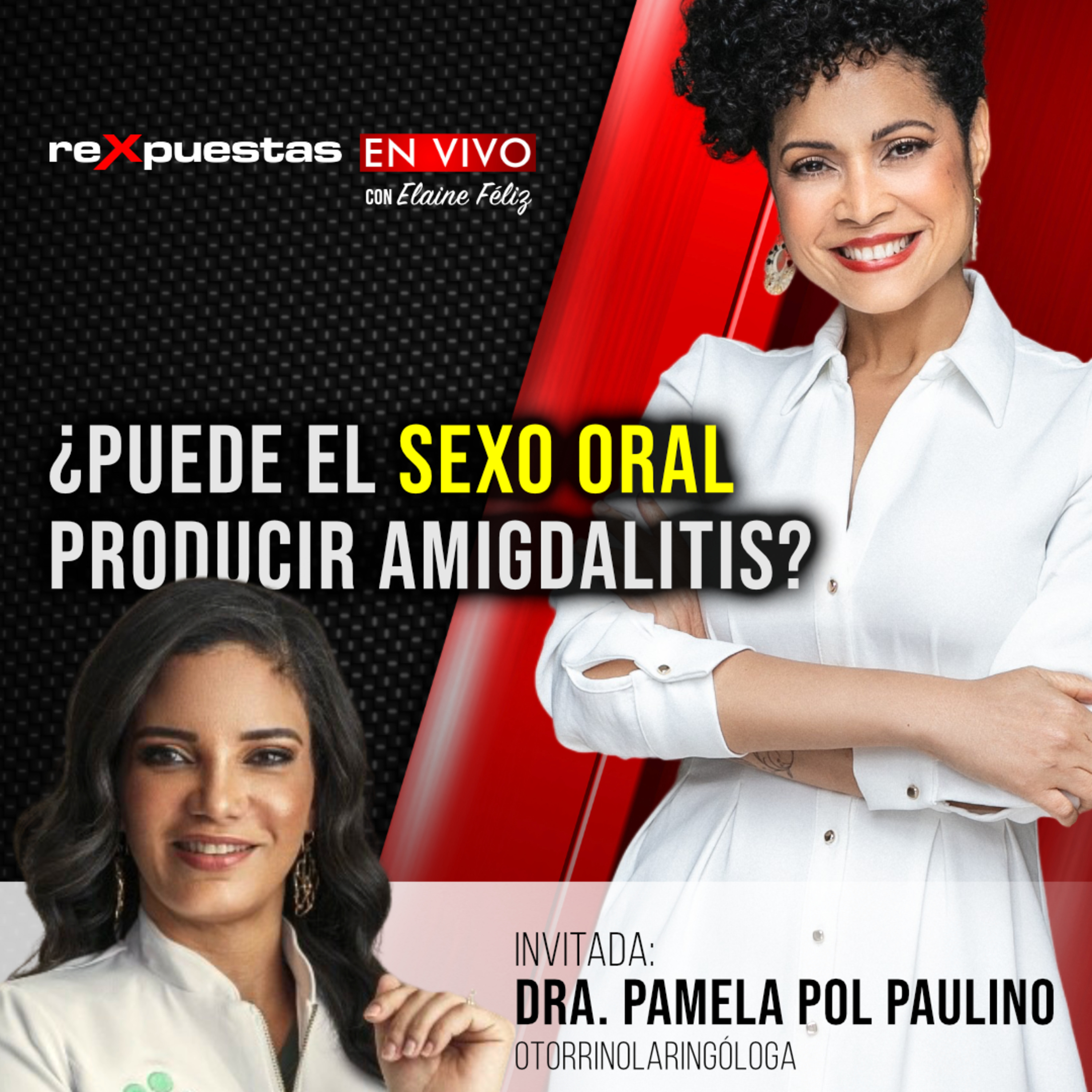 Rexpuestas