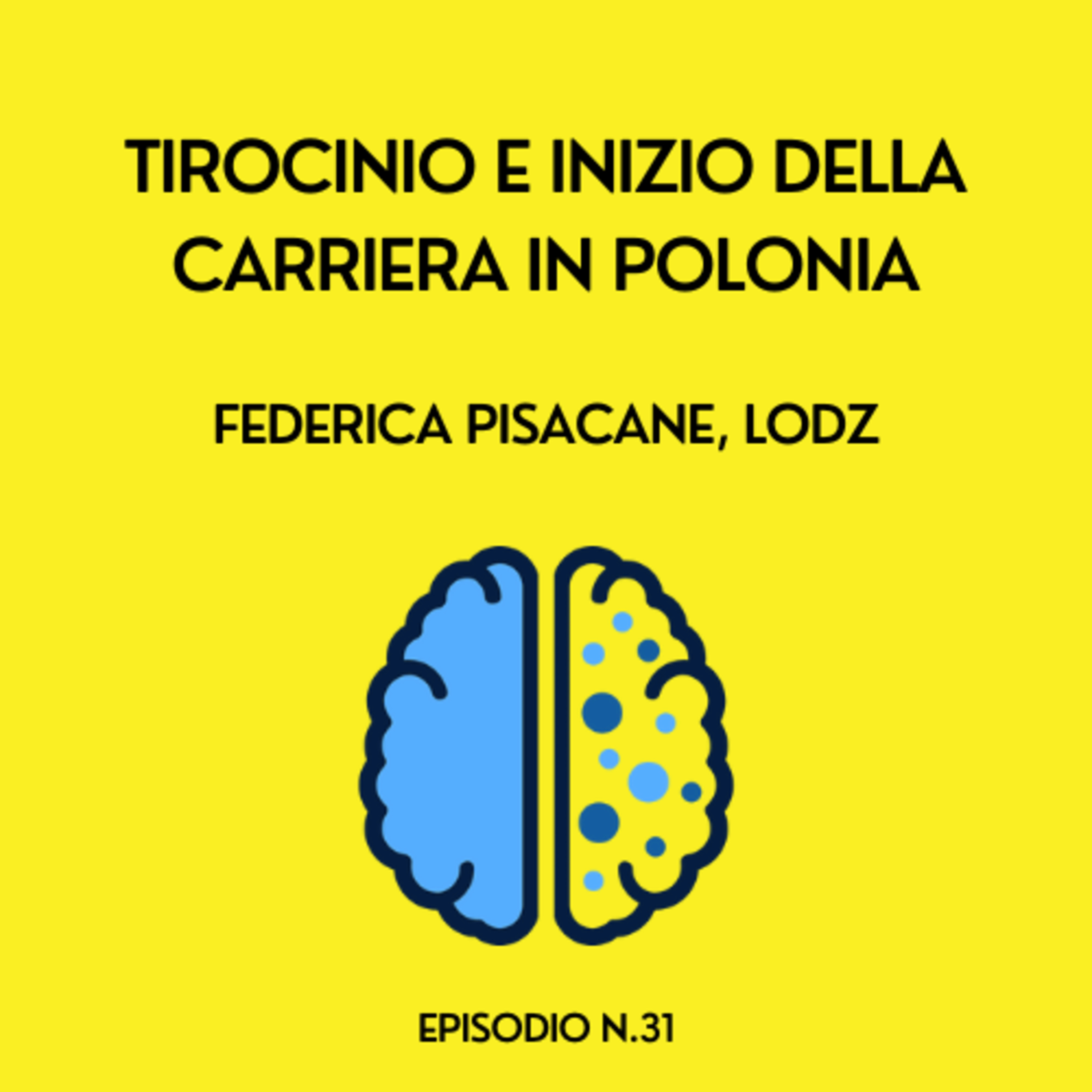 Fuga dei cervelli