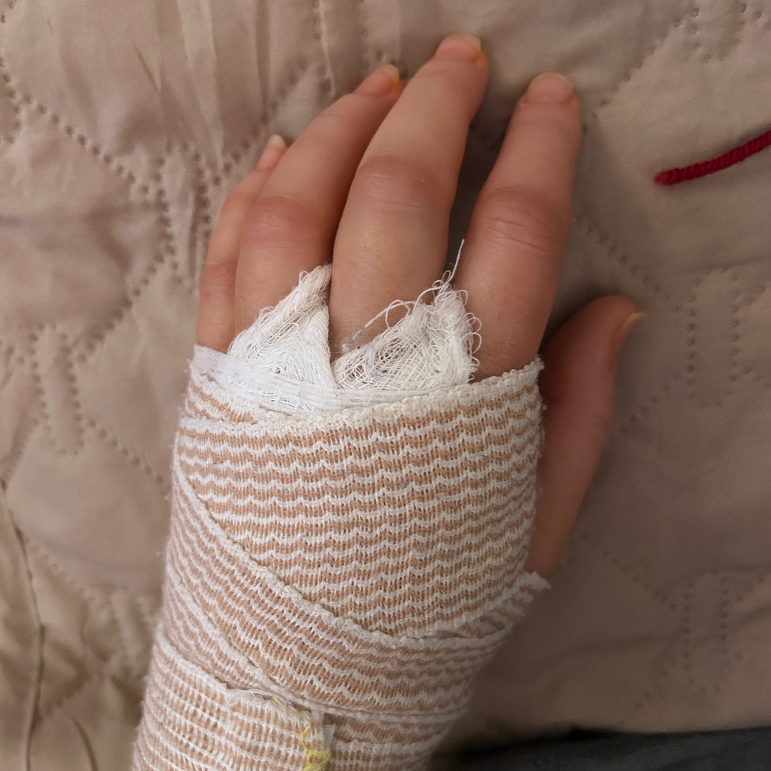 3.9 Help, I'm alive: H is for Hand Surgery