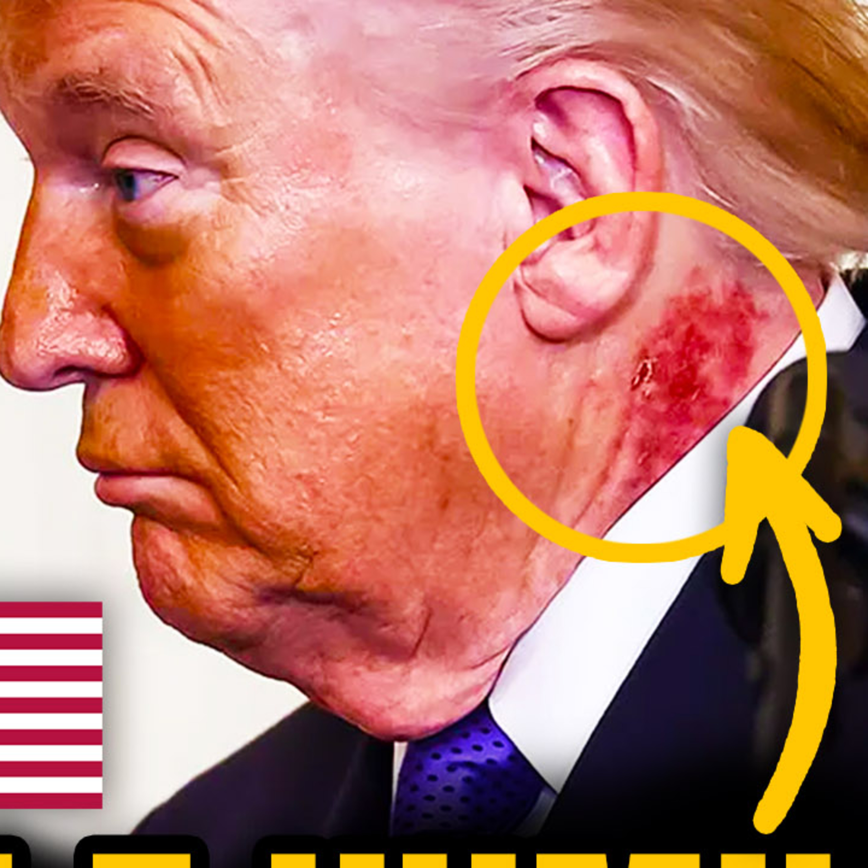 TRUMP DOENTE E HUMILHADO: Saúde em decadência, processos e vídeo RIDÍCULO chocam o mundo! 😱 🇺🇸 episode artwork