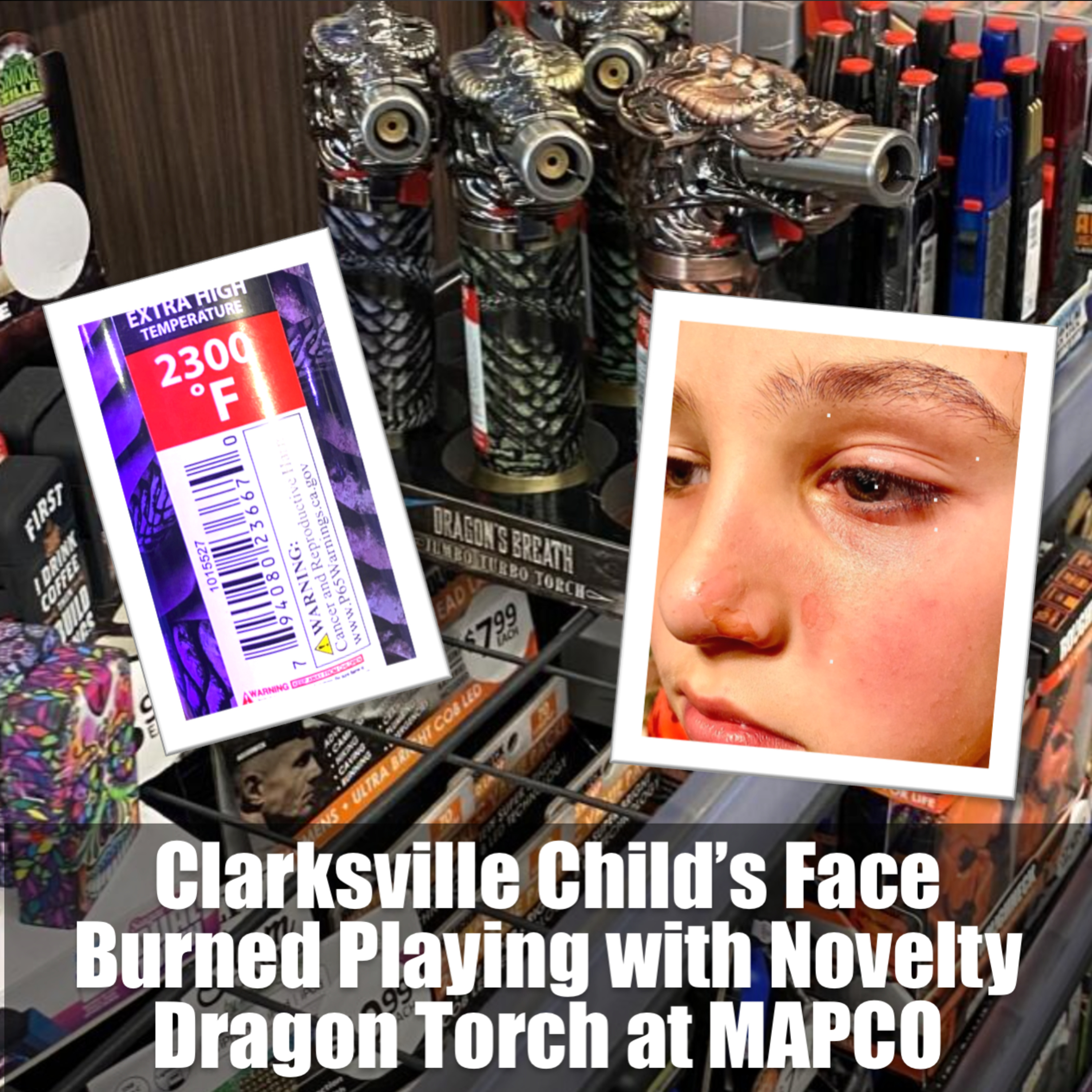 Clarksville Child’s Face Burned Playing with Novelty Dragon Torch at MAPCO episode artwork