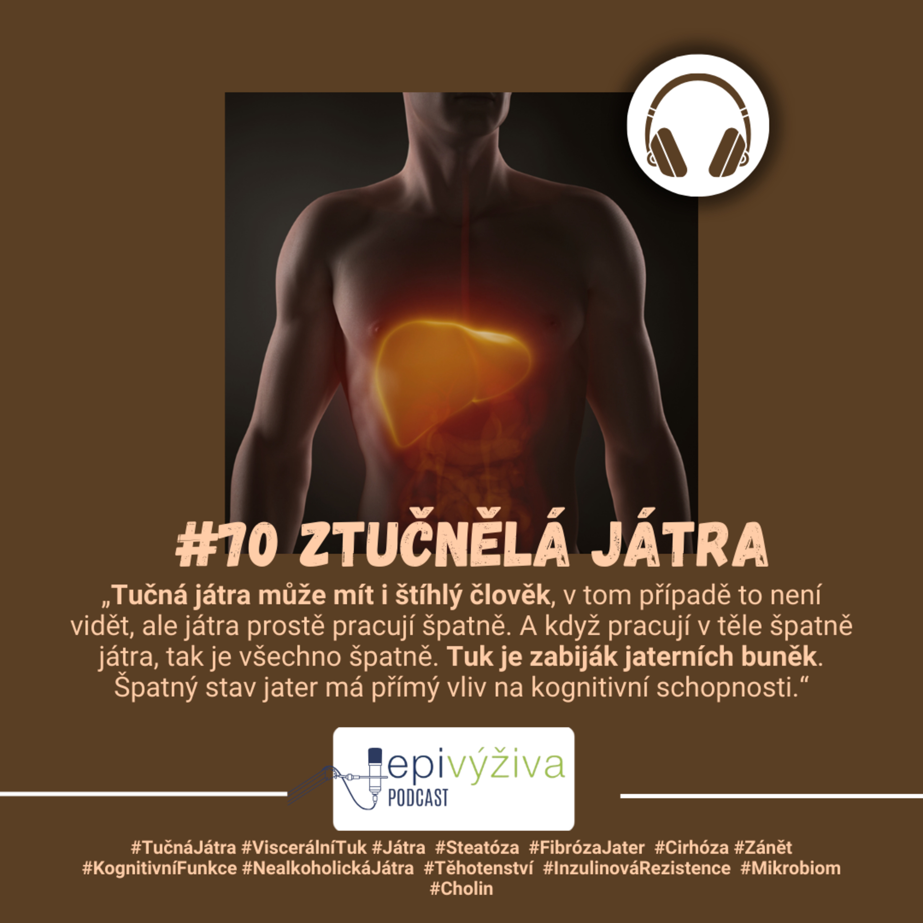 #70 ZTUČNĚLÁ JÁTRA / tučná játra, viscerální tuk, steatóza, fibróza jater, cirhóza, těhotenství, inzulinová rezistence, mikrobiom, zánět, cholin episode artwork