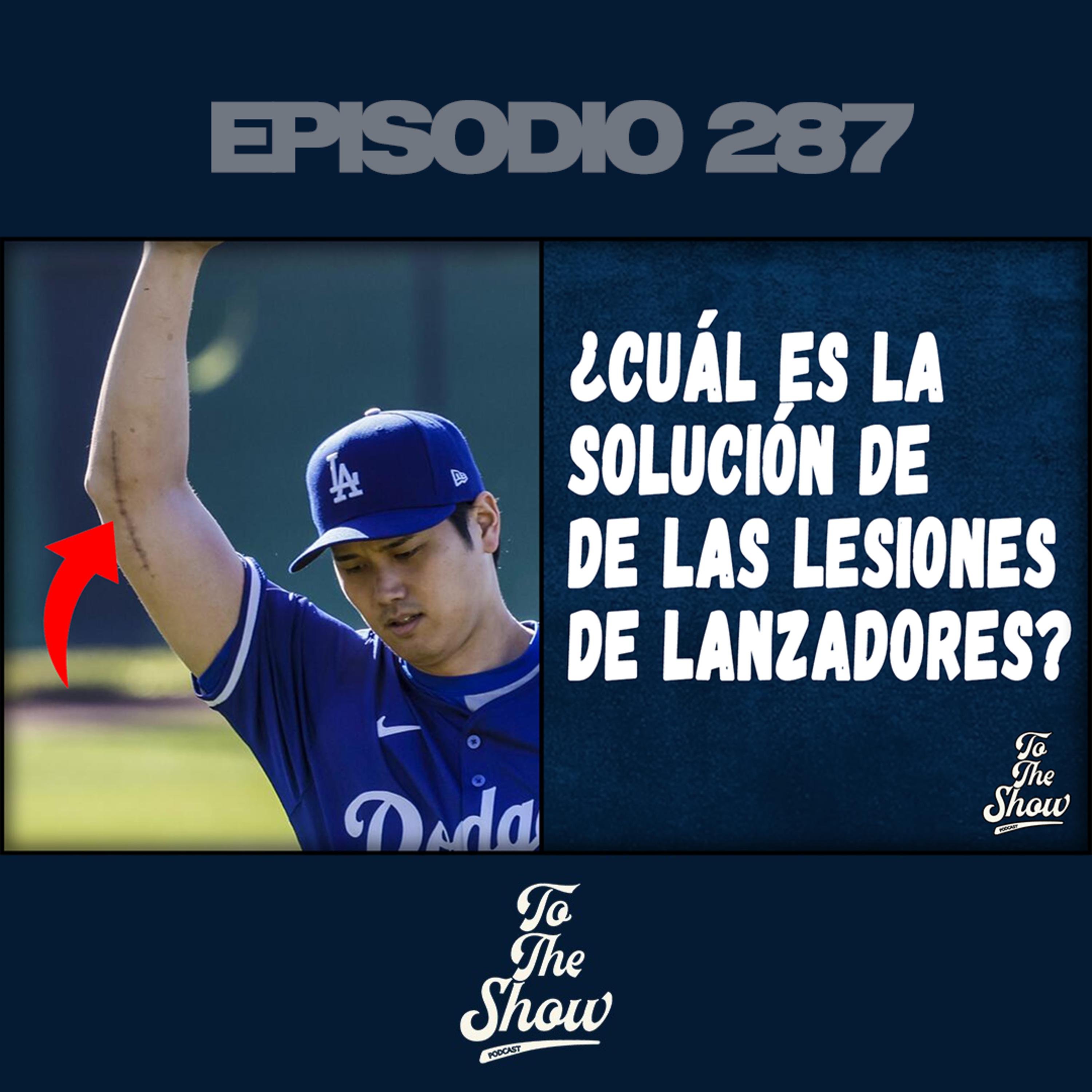 Siguen las lesiones de los lanzadores en Grandes Ligas ¿Cuál es la solución?