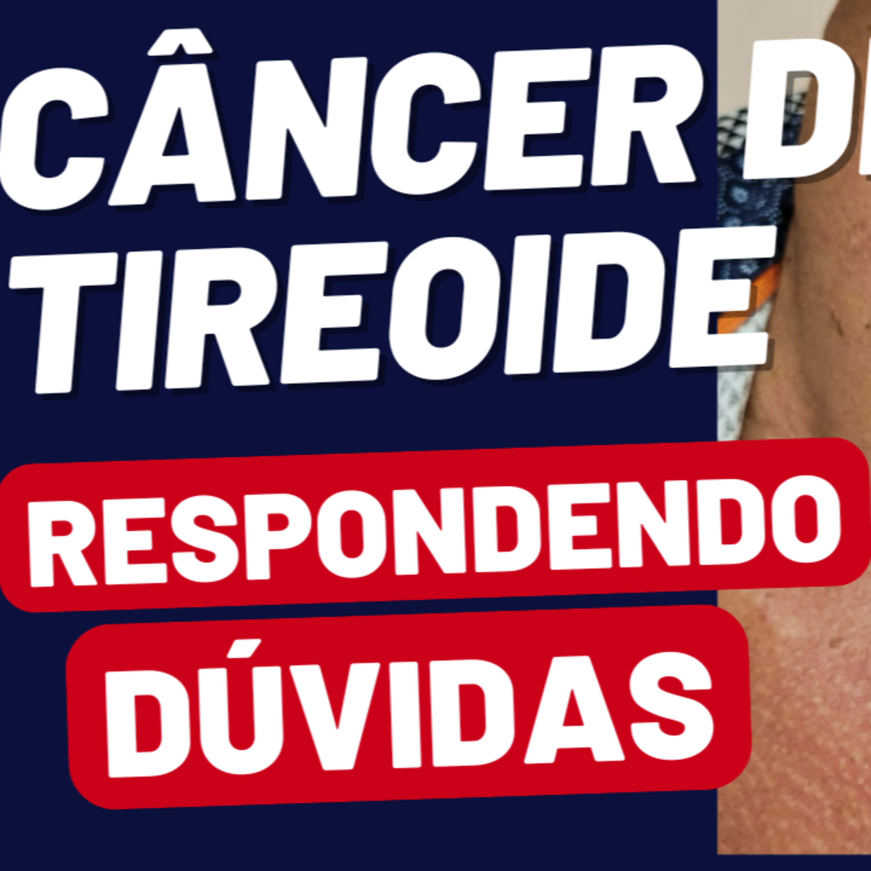Descomplicando a Tireóide - Dr Jônatas Catunda, cirurgião de cabeça e pescoço