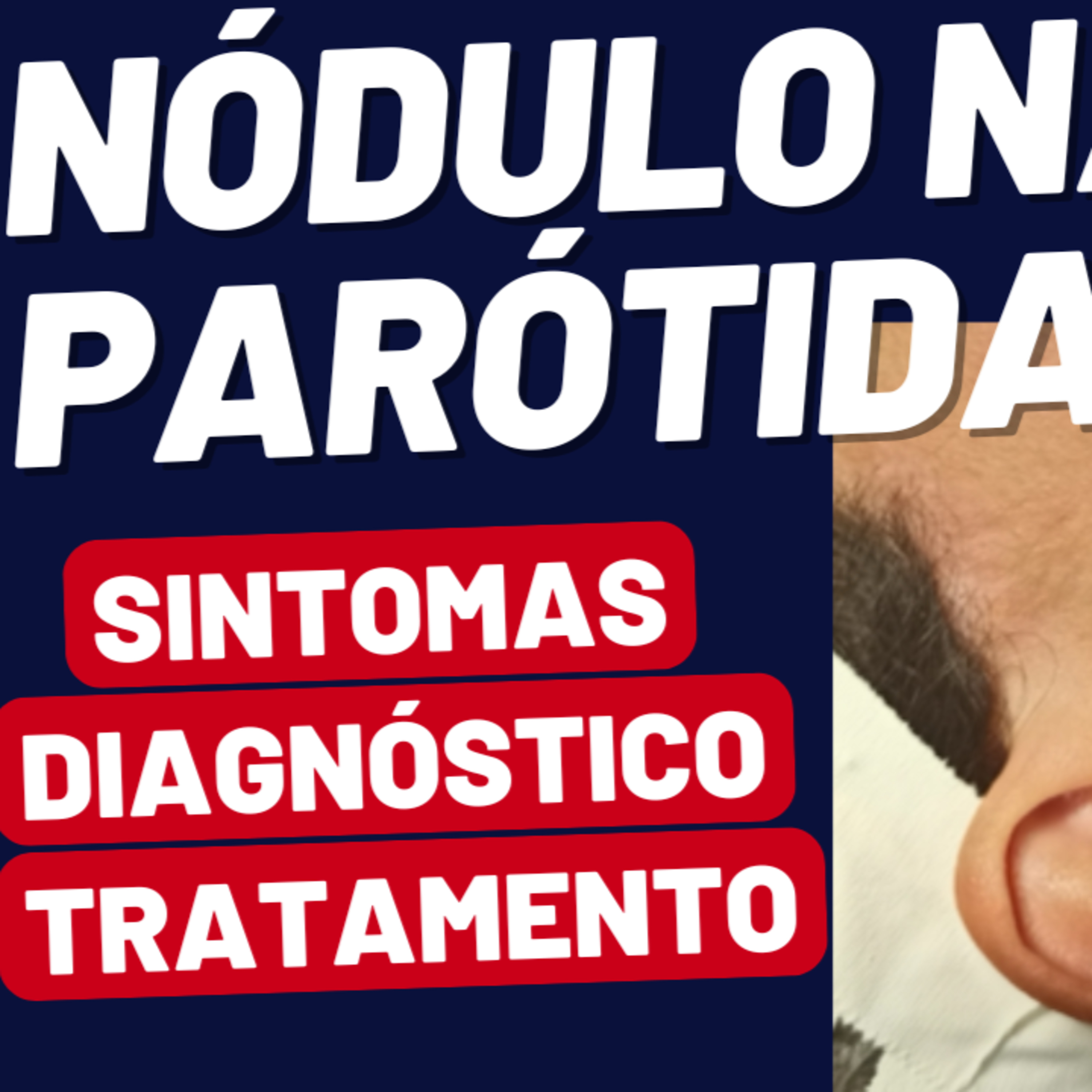 Descomplicando a Tireóide - Dr Jônatas Catunda, cirurgião de cabeça e pescoço